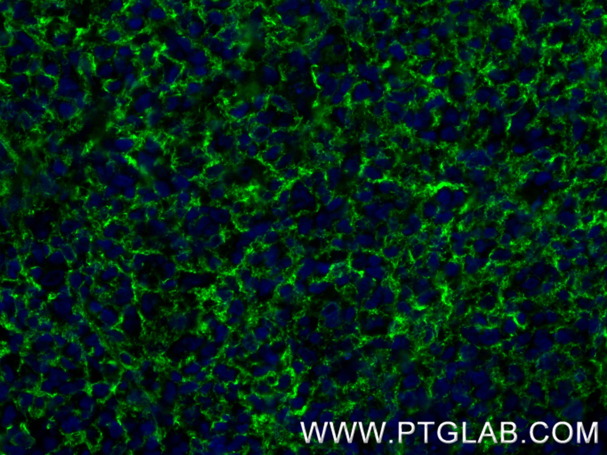 Immunofluorescence (IF) / fluorescent staining of human tonsillitis tissue using VCAM-1/CD106 Recombinant antibody (84249-4-RR)