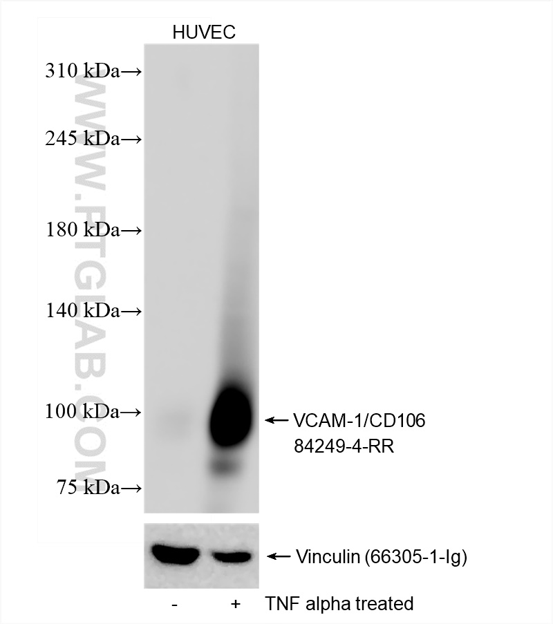 Western Blot (WB) analysis of HUVEC cells using VCAM-1/CD106 Recombinant antibody (84249-4-RR)