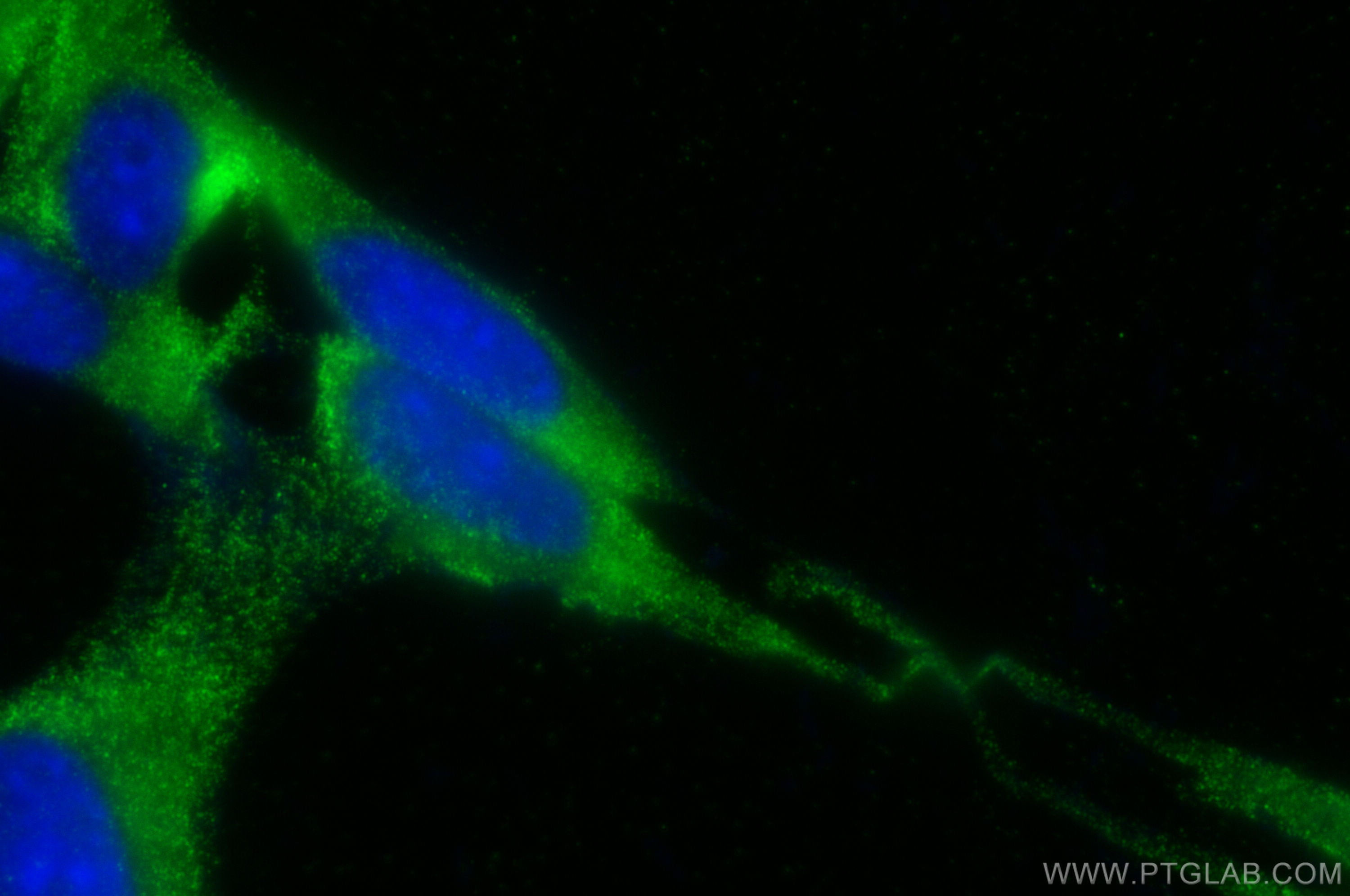 Immunofluorescence (IF) / fluorescent staining of NIH/3T3 cells using VCAN Polyclonal antibody (30599-1-AP)