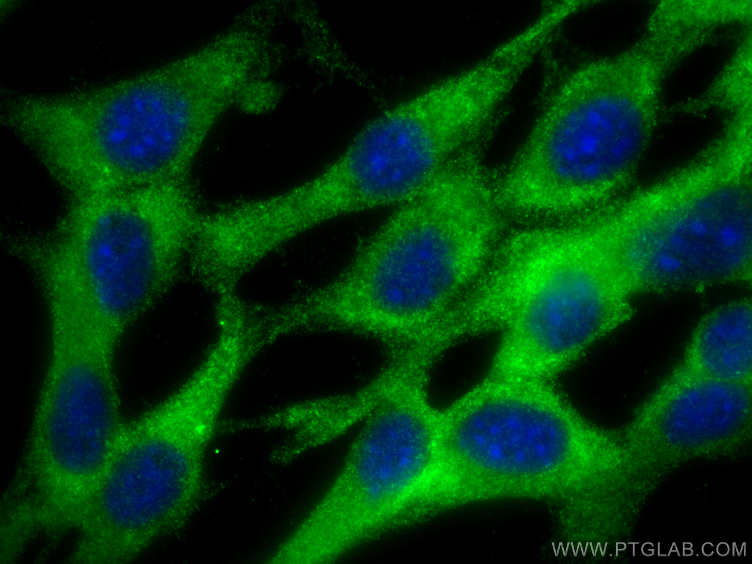 Immunofluorescence (IF) / fluorescent staining of NIH/3T3 cells using VCAN Polyclonal antibody (30599-1-AP)