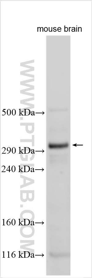 Western Blot (WB) analysis of various lysates using VCAN Polyclonal antibody (30599-1-AP)