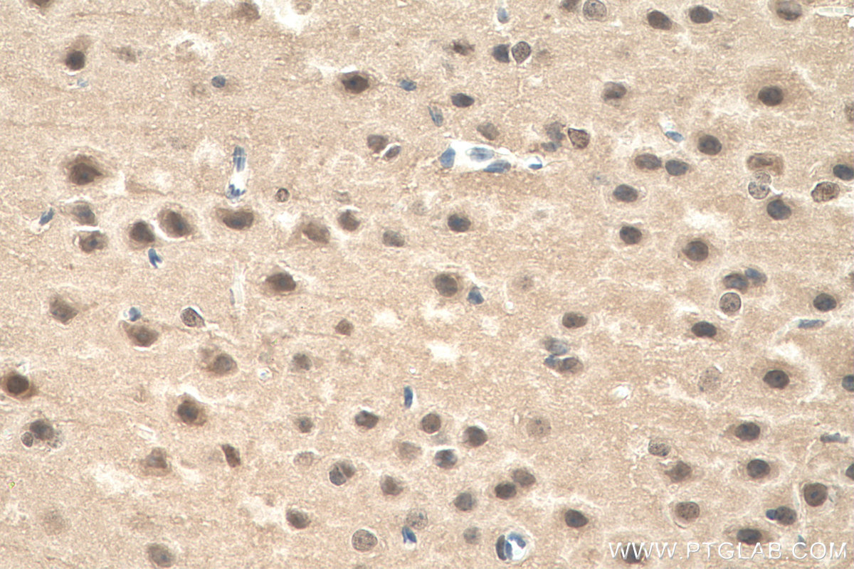 Immunohistochemistry (IHC) staining of mouse brain tissue using VCP Monoclonal antibody (60316-1-Ig)