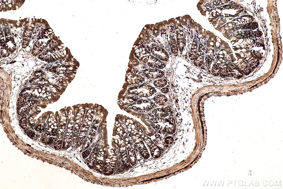 Immunohistochemistry (IHC) staining of mouse colon tissue using VCP Monoclonal antibody (60316-1-Ig)