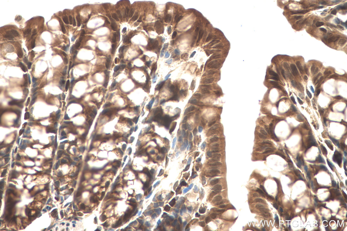 Immunohistochemistry (IHC) staining of mouse colon tissue using VCP Monoclonal antibody (60316-1-Ig)