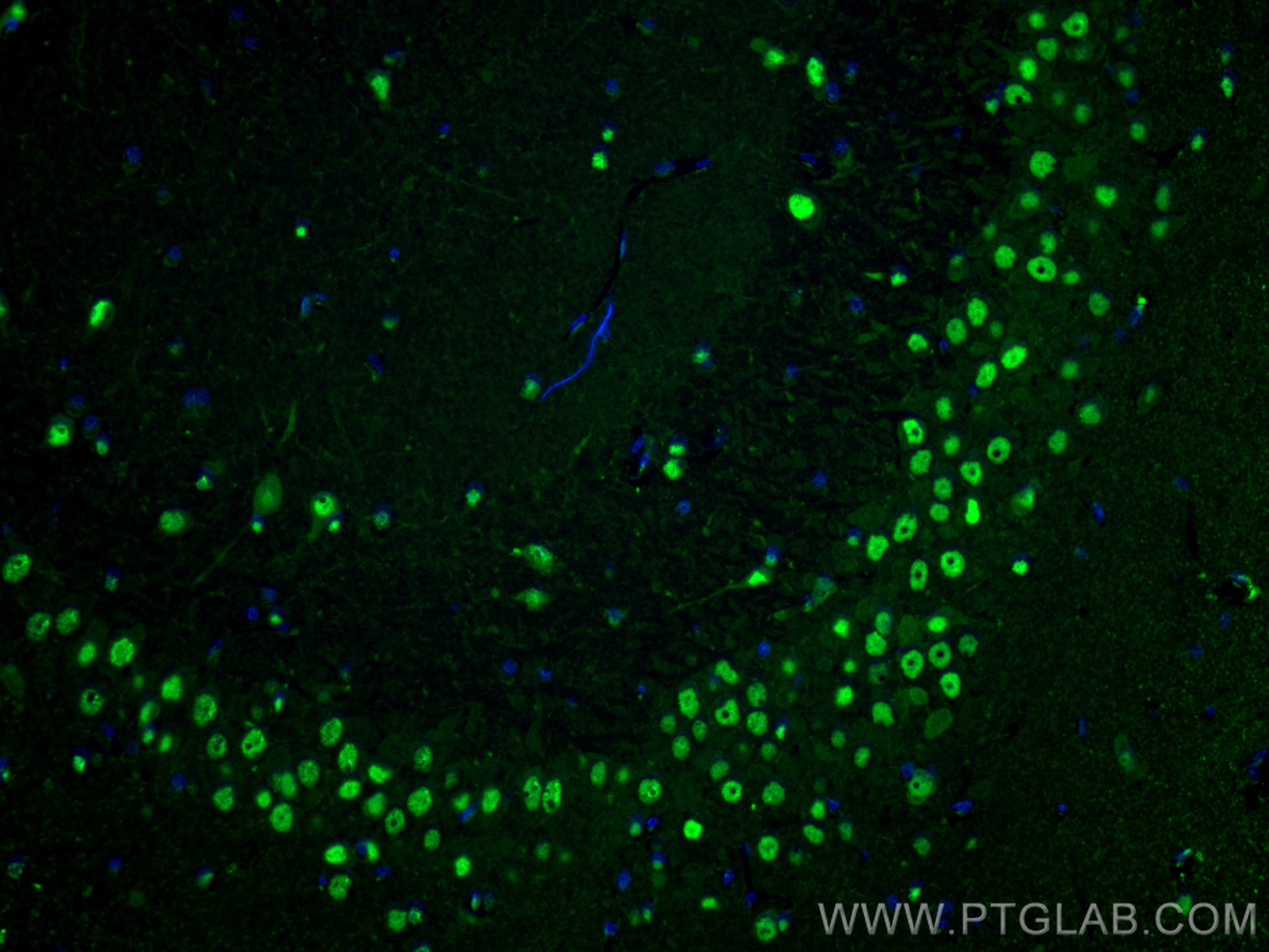 Immunofluorescence (IF) / fluorescent staining of rat brain tissue using VCP Recombinant antibody (82463-1-RR)