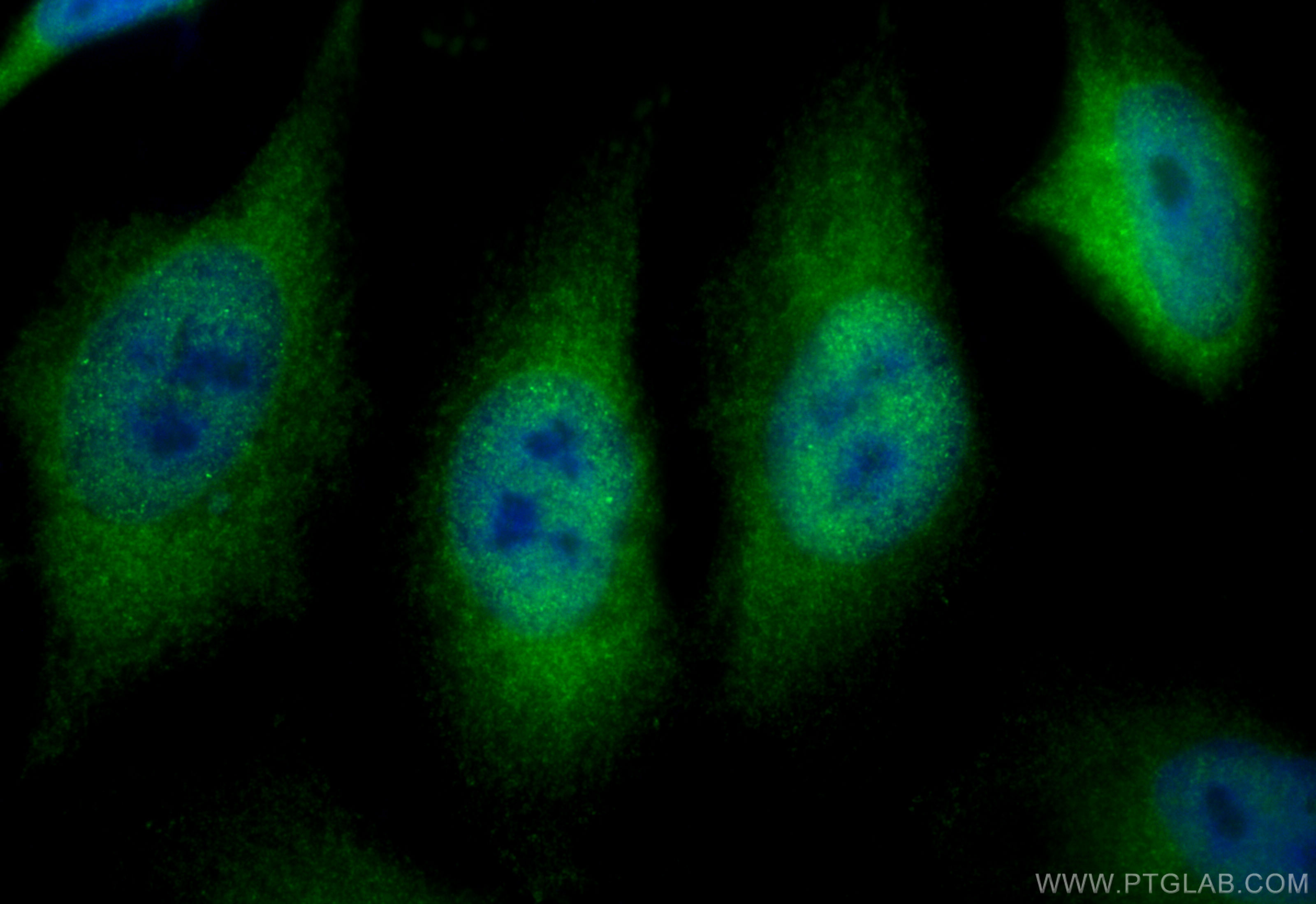 Immunofluorescence (IF) / fluorescent staining of HeLa cells using VCP Recombinant antibody (82463-1-RR)