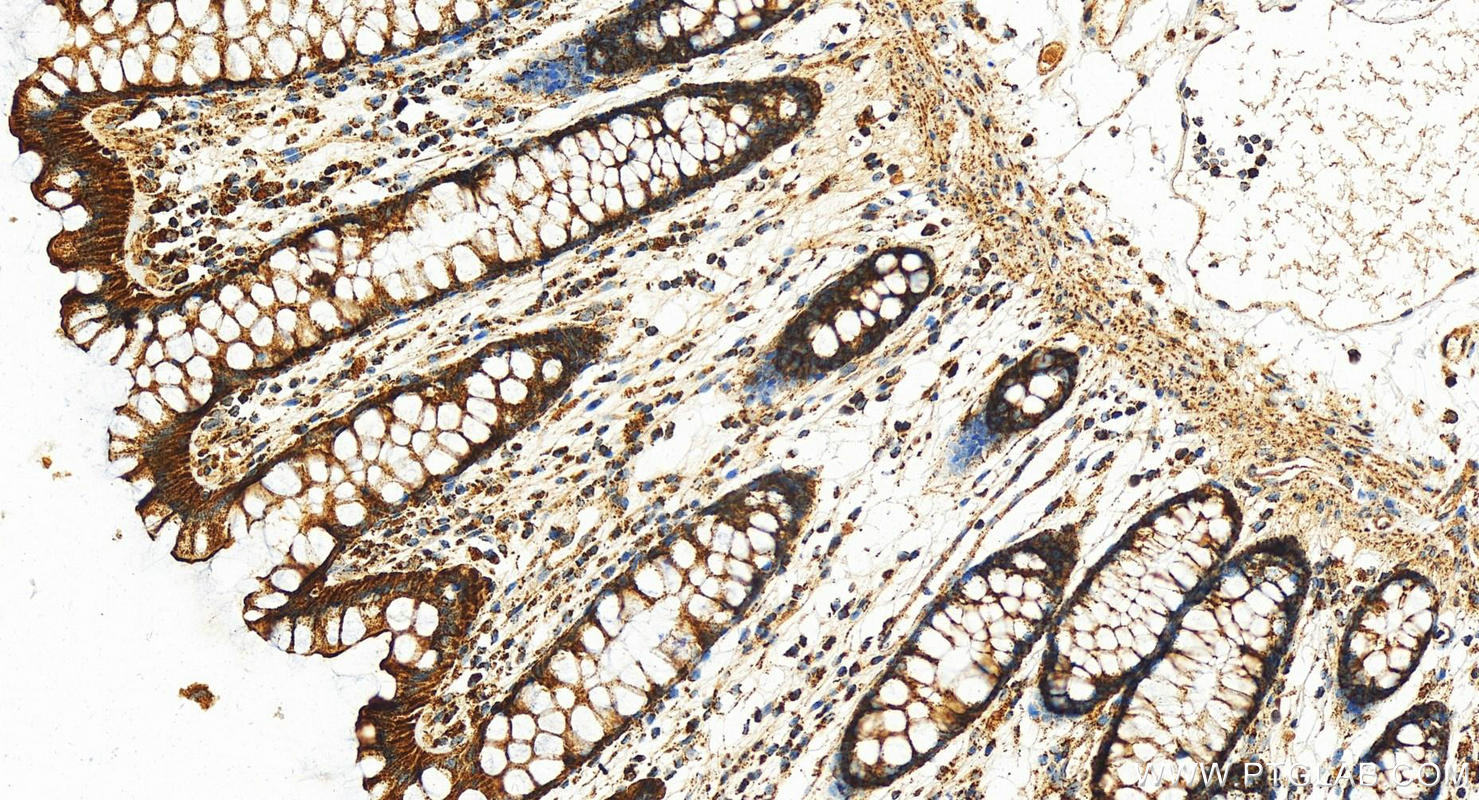 Immunohistochemistry (IHC) staining of human normal colon using VDAC1/2/3 Polyclonal antibody (11663-1-AP)