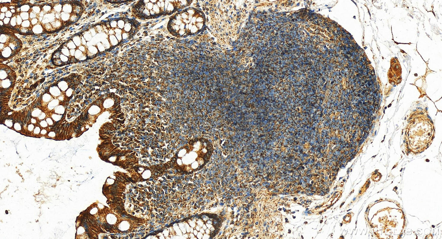 Immunohistochemistry (IHC) staining of human normal colon using VDAC1/2/3 Polyclonal antibody (11663-1-AP)