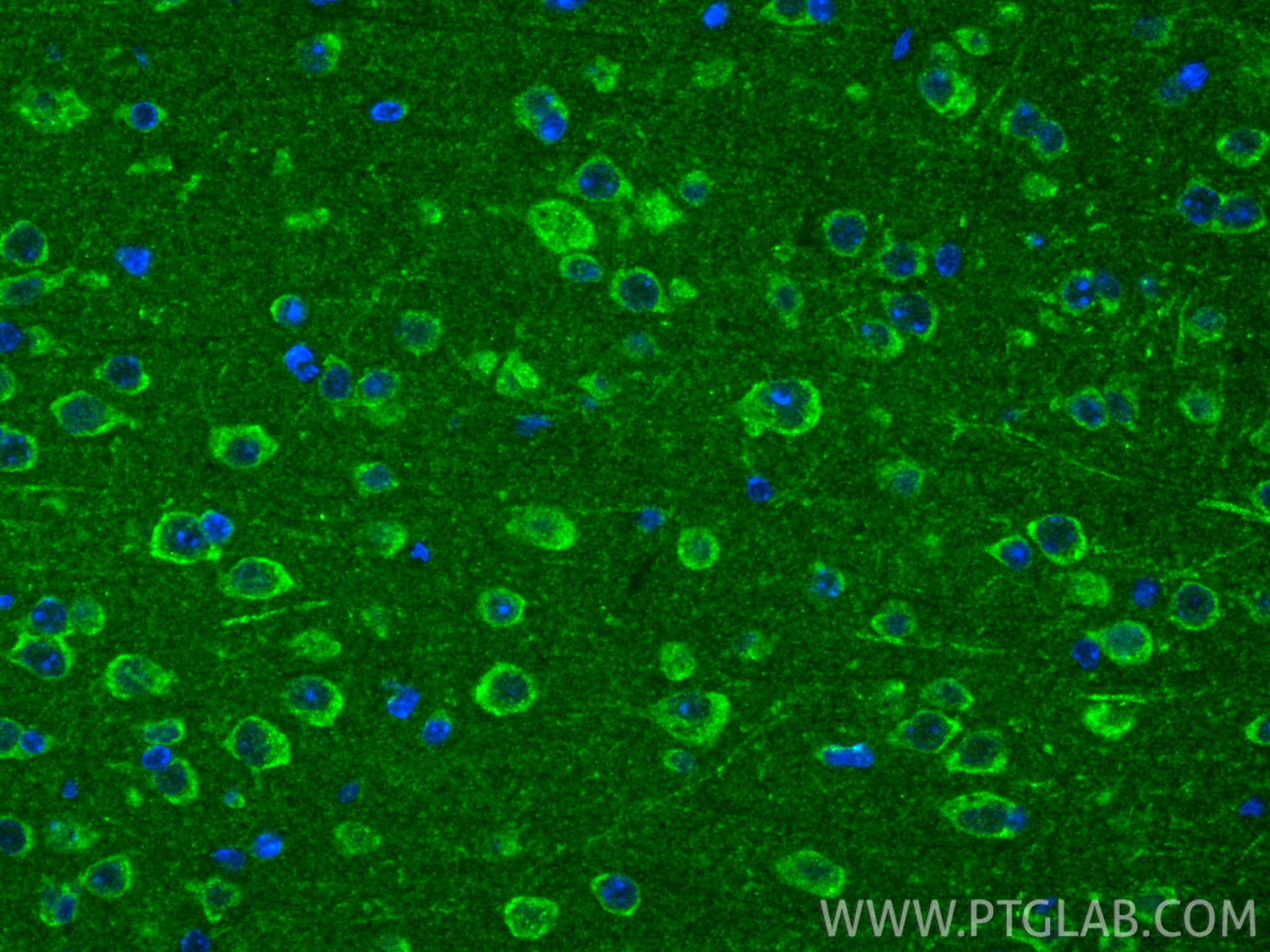 Immunofluorescence (IF) / fluorescent staining of mouse brain tissue using VDAC2 Polyclonal antibody (55261-1-AP)