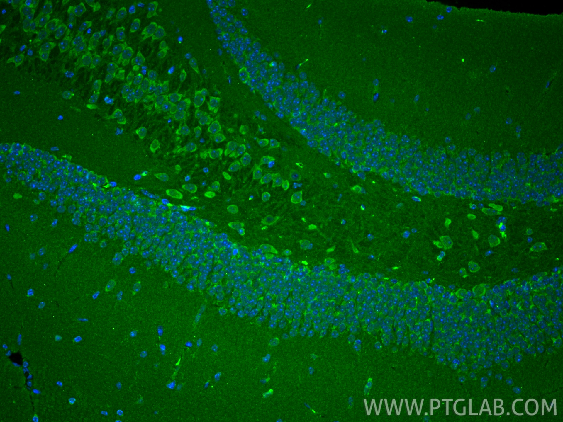 Immunofluorescence (IF) / fluorescent staining of mouse brain tissue using VDAC2 Monoclonal antibody (66388-1-Ig)