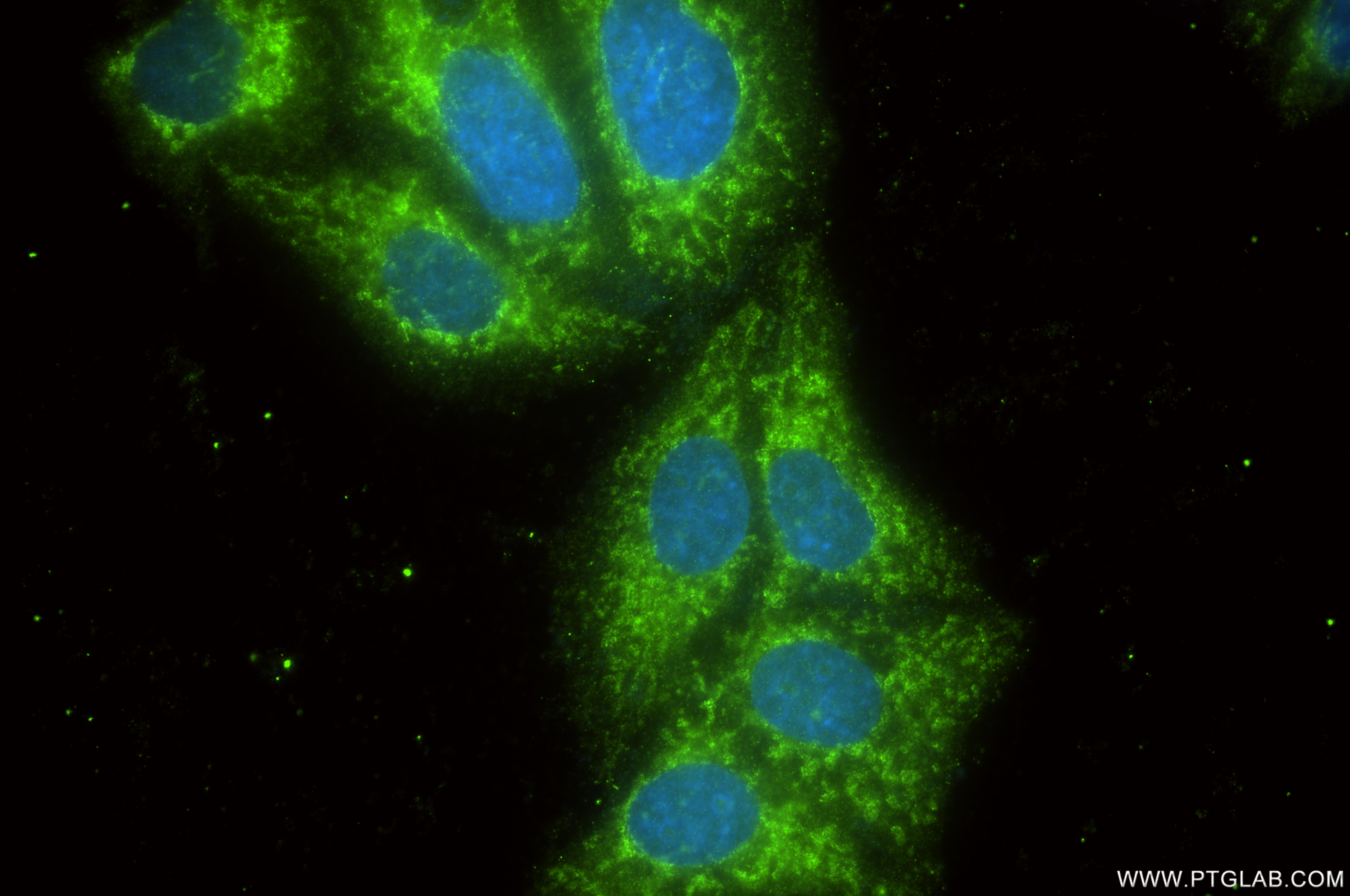 Immunofluorescence (IF) / fluorescent staining of HepG2 cells using VDAC2 Recombinant monoclonal antibody (84225-2-RR)