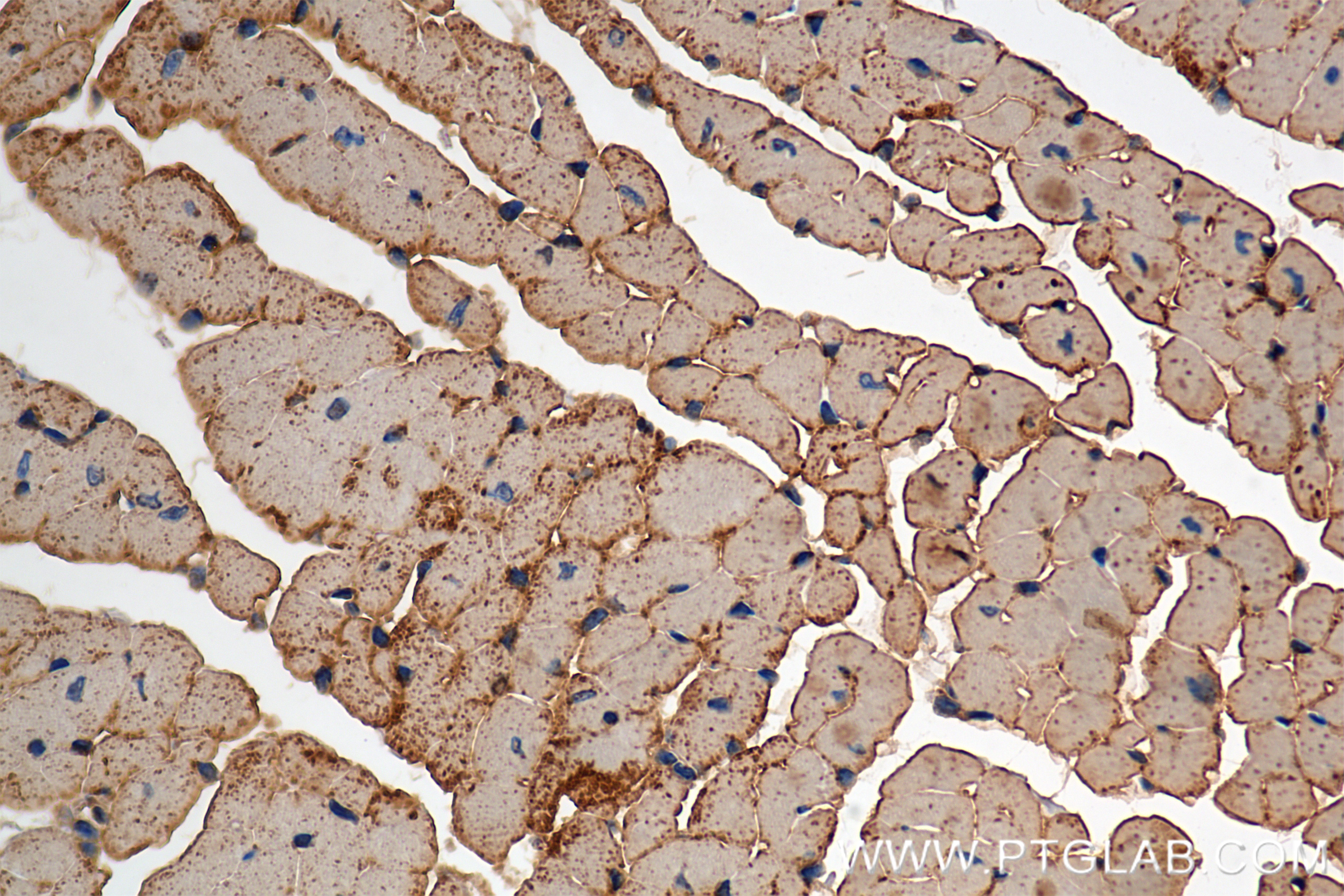 Immunohistochemistry (IHC) staining of mouse heart tissue using VDAC2 Recombinant monoclonal antibody (84225-2-RR)