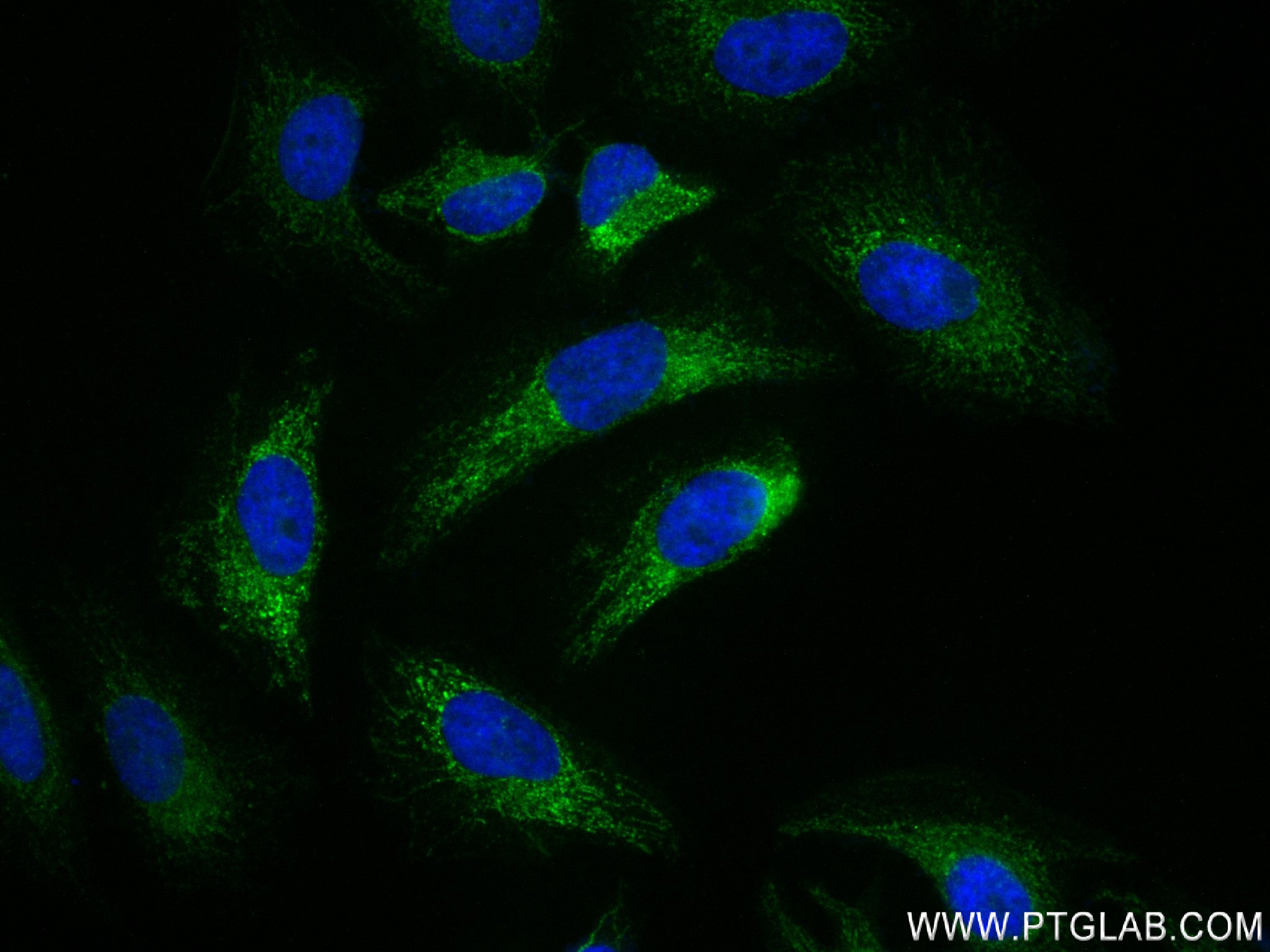 Immunofluorescence (IF) / fluorescent staining of HeLa cells using VDAC2 Recombinant antibody (84225-3-RR)