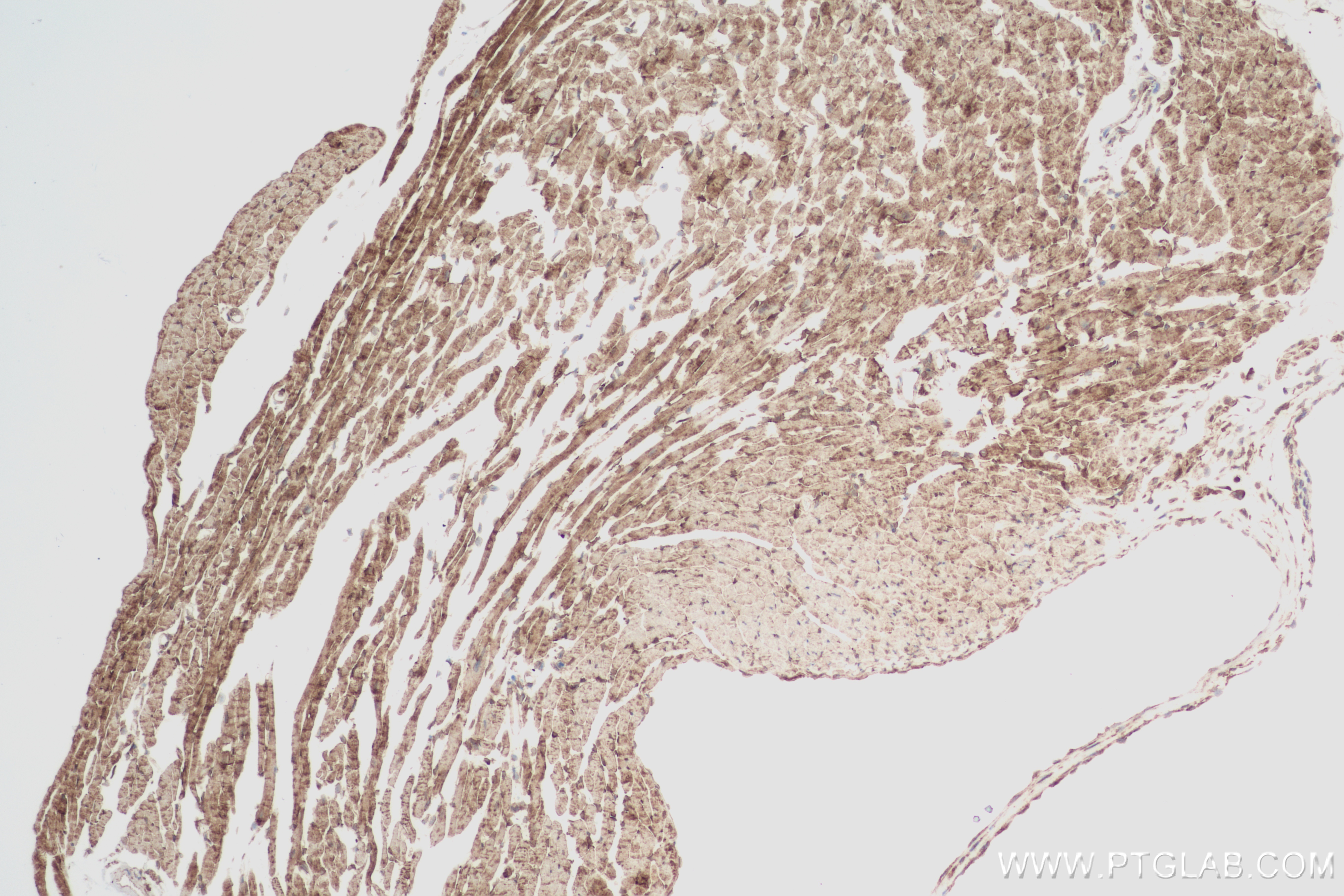 Immunohistochemistry (IHC) staining of mouse heart tissue using VDAC2 Recombinant antibody (84225-3-RR)