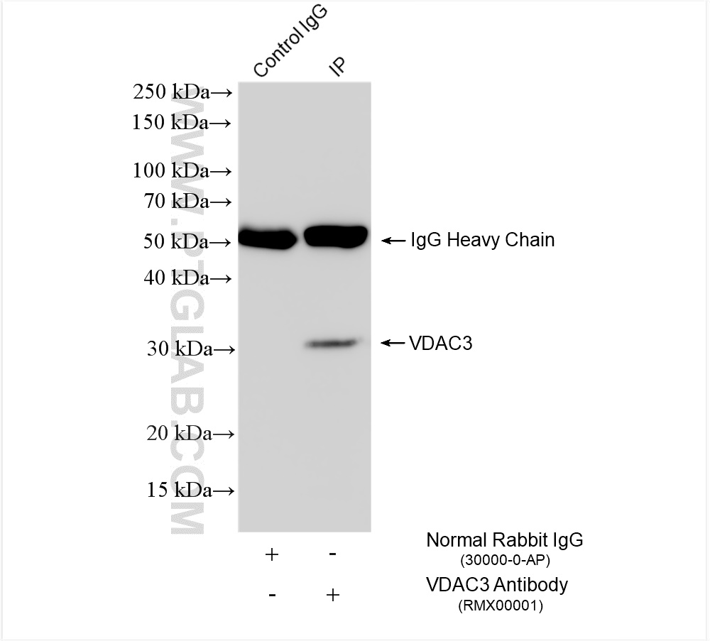 Immunoprecipitation (IP) experiment of HeLa cells using VDAC3 Rabbit PolyAb (RMX00001)