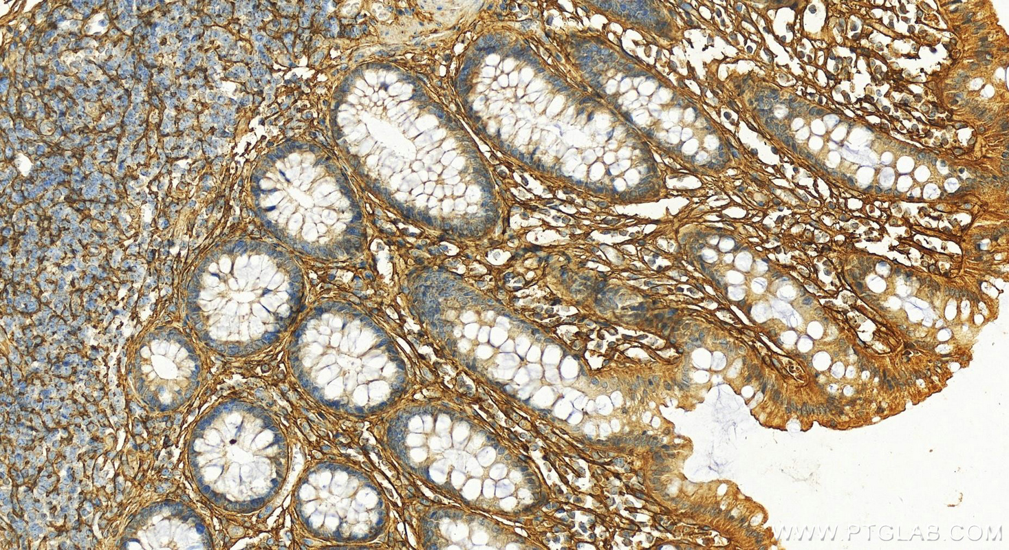 Immunohistochemistry (IHC) staining of human normal colon using Vitamin D binding protein Polyclonal antibody (16922-1-AP)