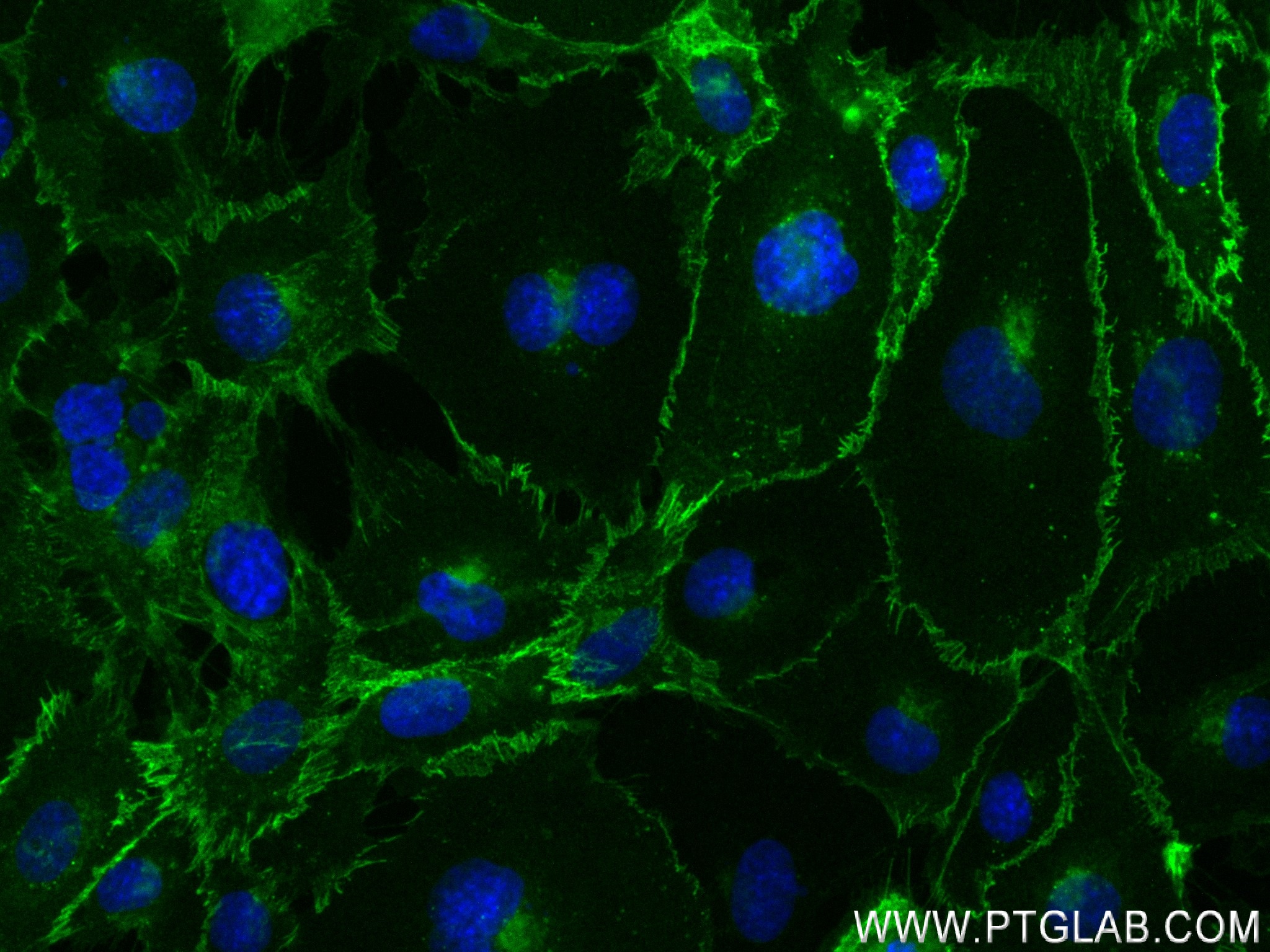 Immunofluorescence (IF) / fluorescent staining of HUVEC cells using VE-cadherin/CD144 Recombinant antibody (83766-2-RR)