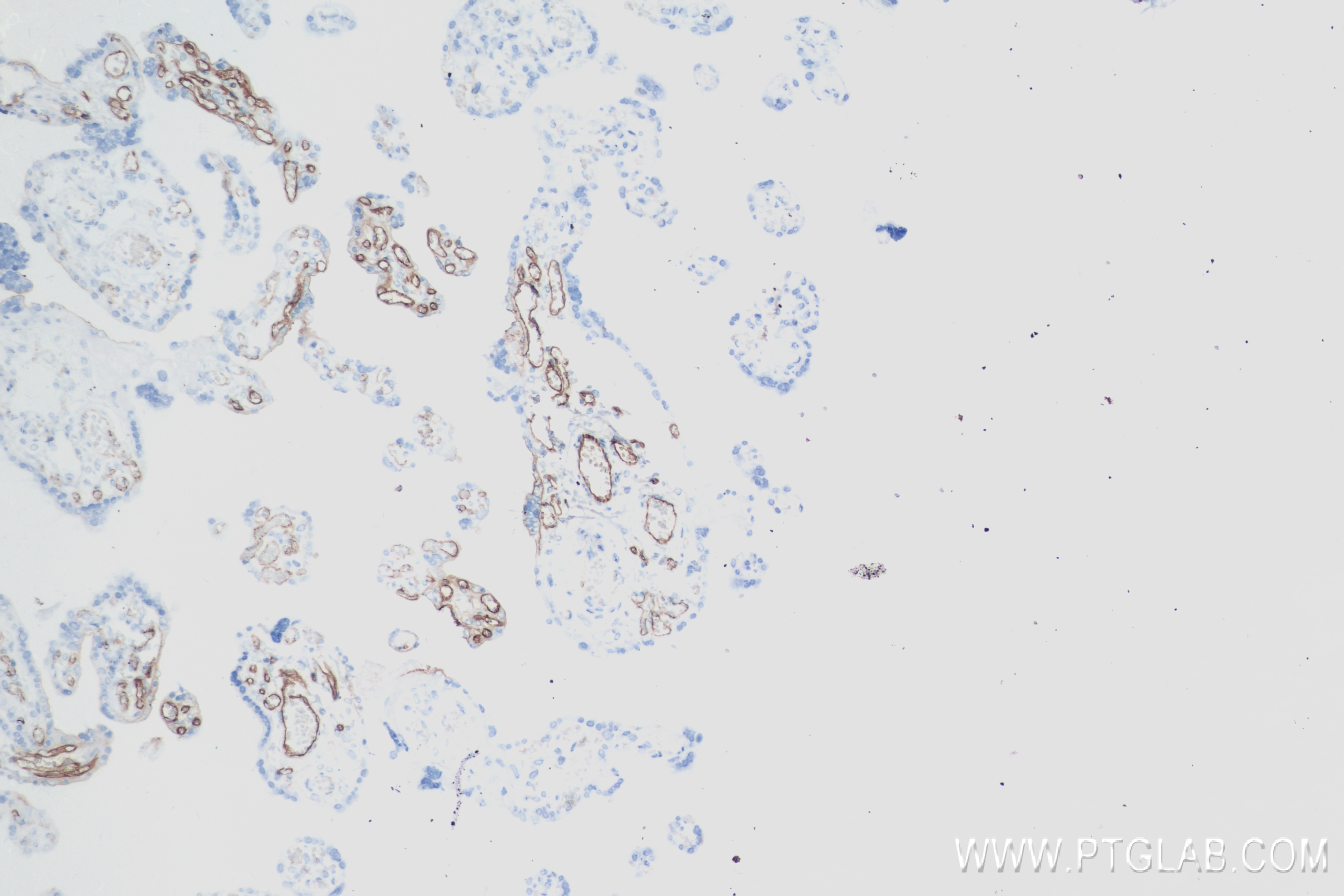 Immunohistochemistry (IHC) staining of human placenta tissue using VE-cadherin Recombinant antibody (83766-2-RR)