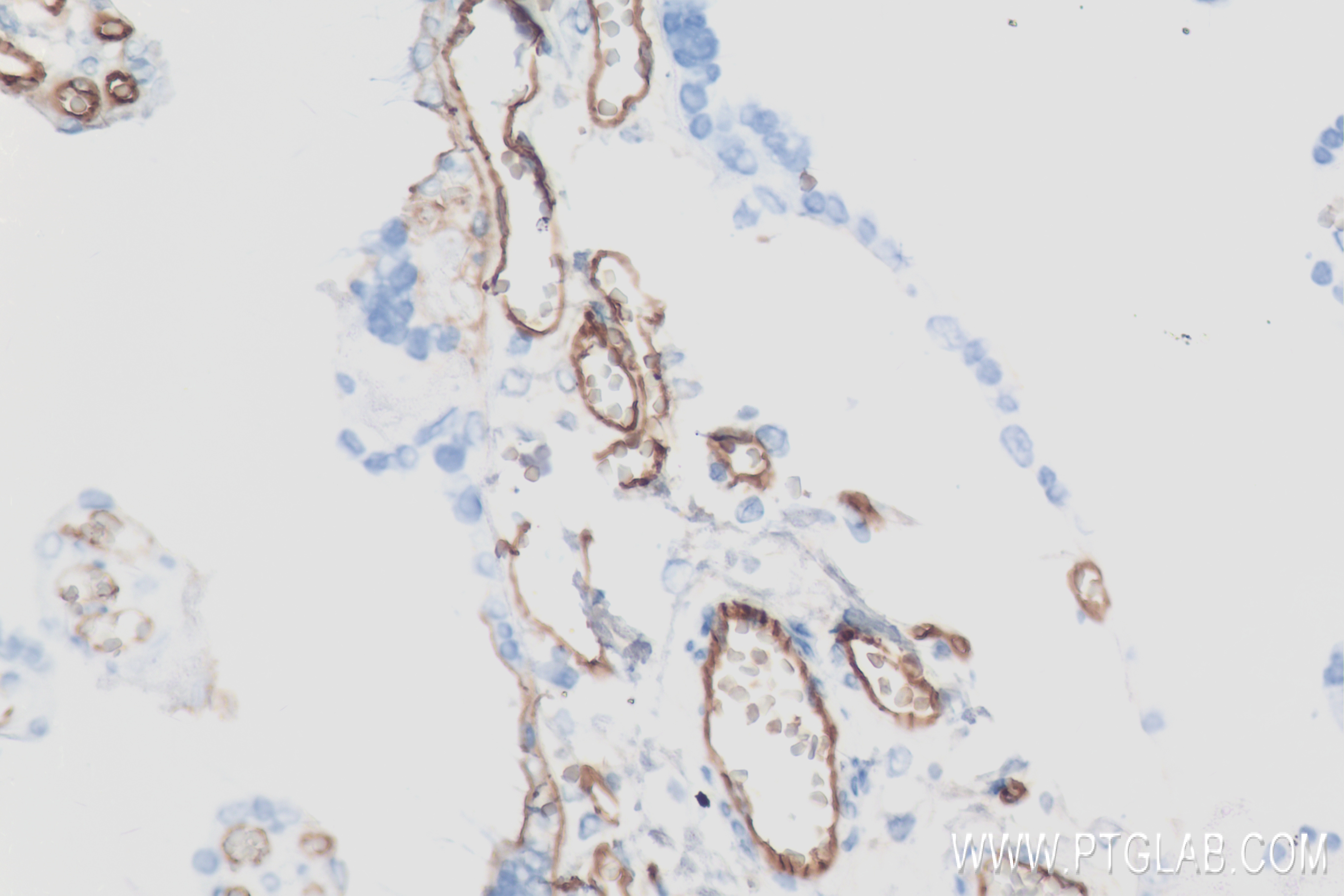 Immunohistochemistry (IHC) staining of human placenta tissue using VE-cadherin/CD144 Recombinant antibody (83766-2-RR)