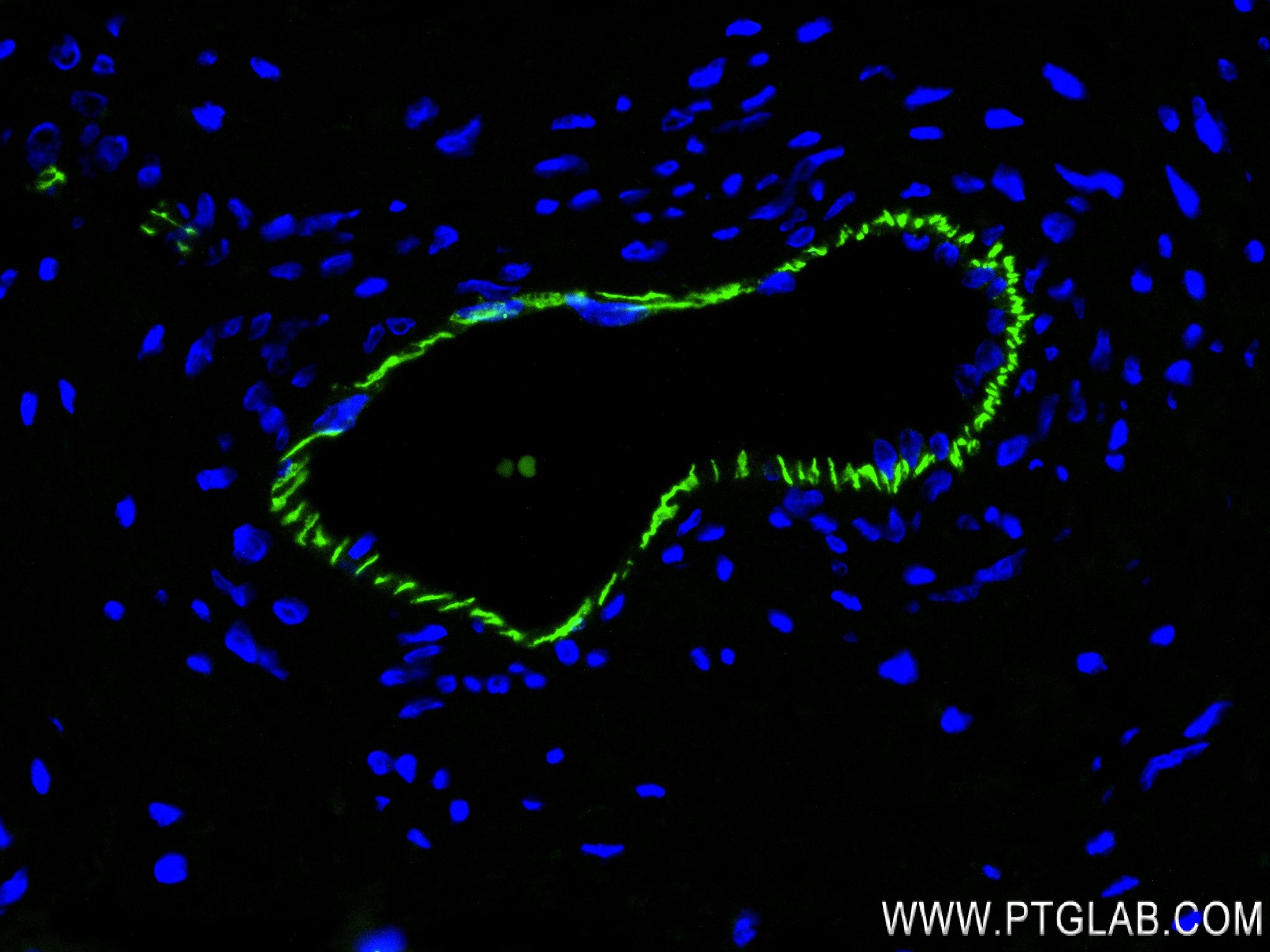 Immunofluorescence (IF) / fluorescent staining of human placenta tissue using VE-cadherin/CD144 Recombinant antibody (83766-6-RR)