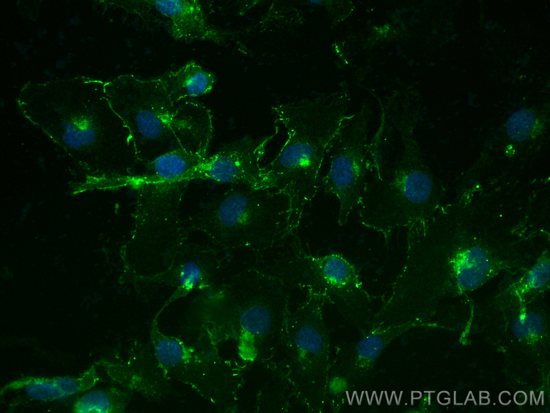 Immunofluorescence (IF) / fluorescent staining of HUVEC cells using CoraLite® Plus 488-conjugated VE-cadherin/CD144 Re (CL488-83766-2)