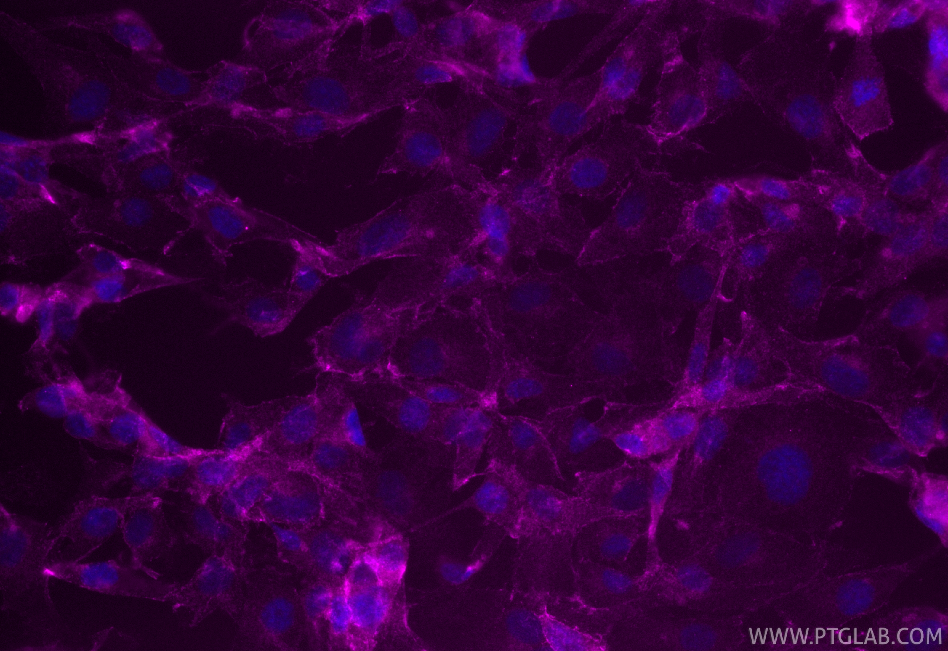 Immunofluorescence (IF) / fluorescent staining of HUVEC cells using CoraLite® Plus 647-conjugated VE-cadherin/CD144 Mo (CL647-66804)