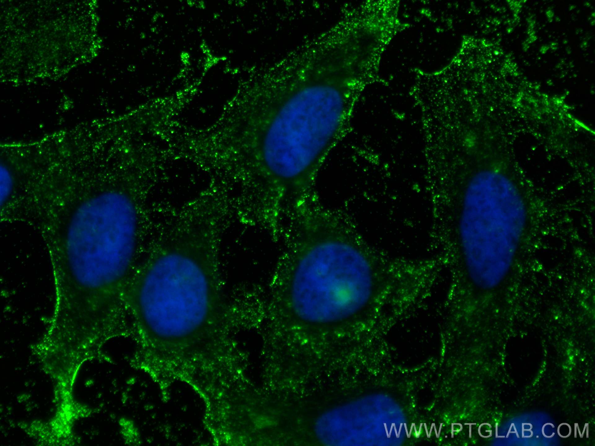 Immunofluorescence (IF) / fluorescent staining of HeLa cells using VEGFA Polyclonal antibody (19003-1-AP)