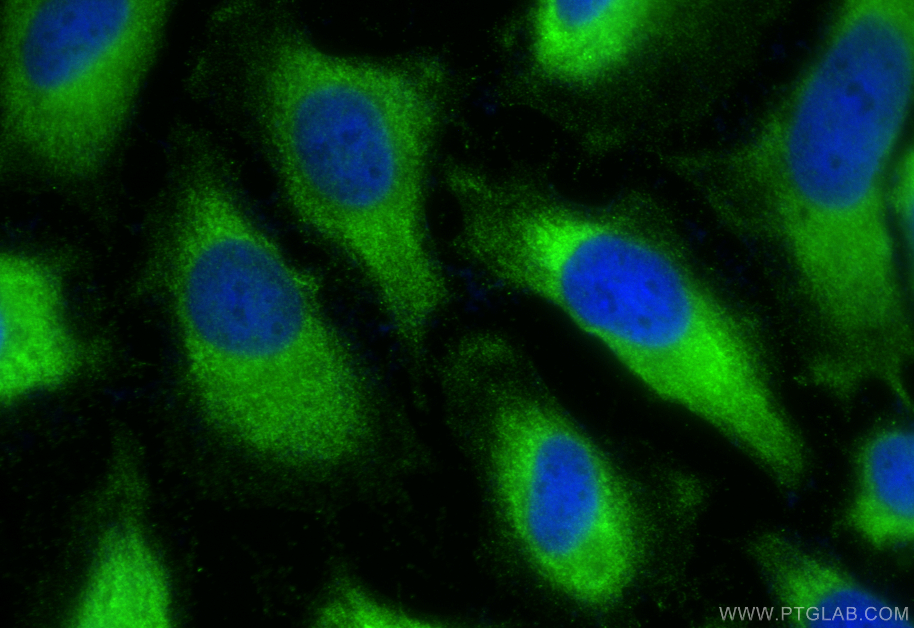 Immunofluorescence (IF) / fluorescent staining of HeLa cells using VEGFA Polyclonal antibody (19003-1-AP)