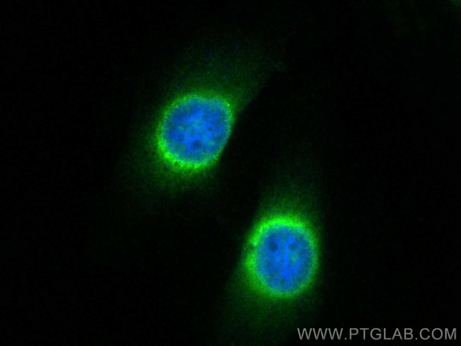 Immunofluorescence (IF) / fluorescent staining of HeLa cells using VEGFA Recombinant antibody (81323-2-RR)