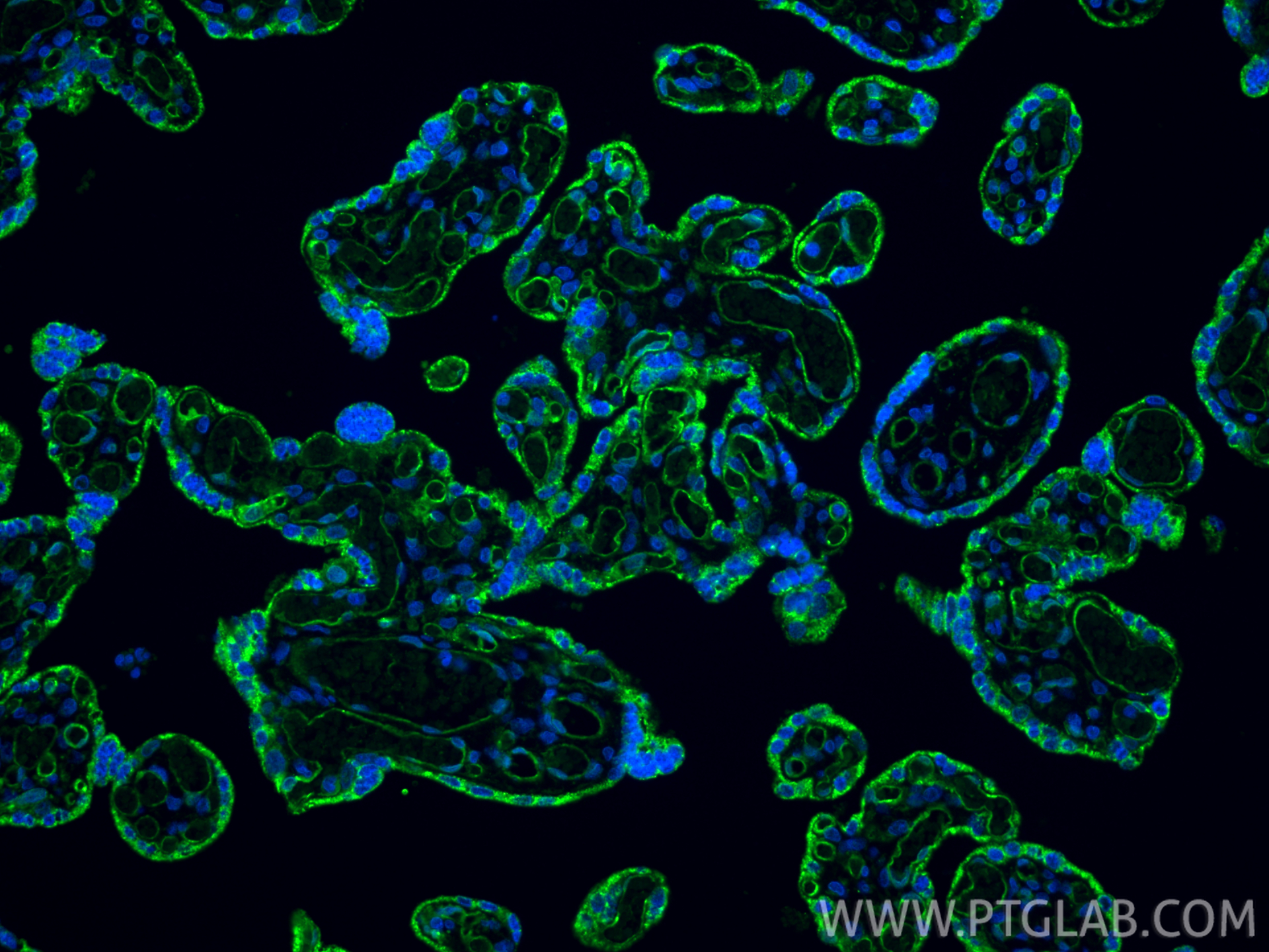 Immunofluorescence (IF) / fluorescent staining of human placenta tissue using VEGFR2/KDR Polyclonal antibody (26415-1-AP)