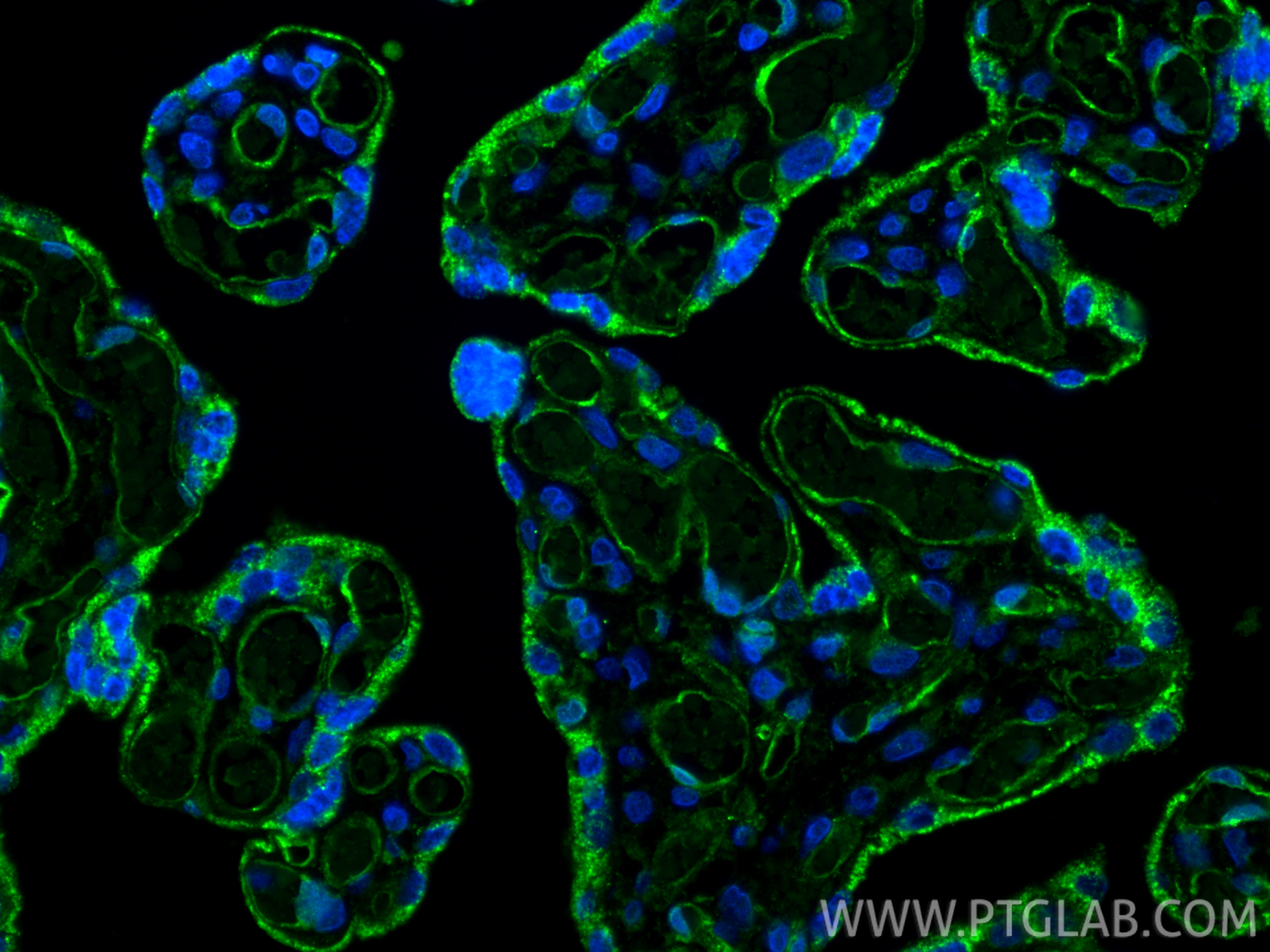 Immunofluorescence (IF) / fluorescent staining of human placenta tissue using VEGFR2/KDR Polyclonal antibody (26415-1-AP)