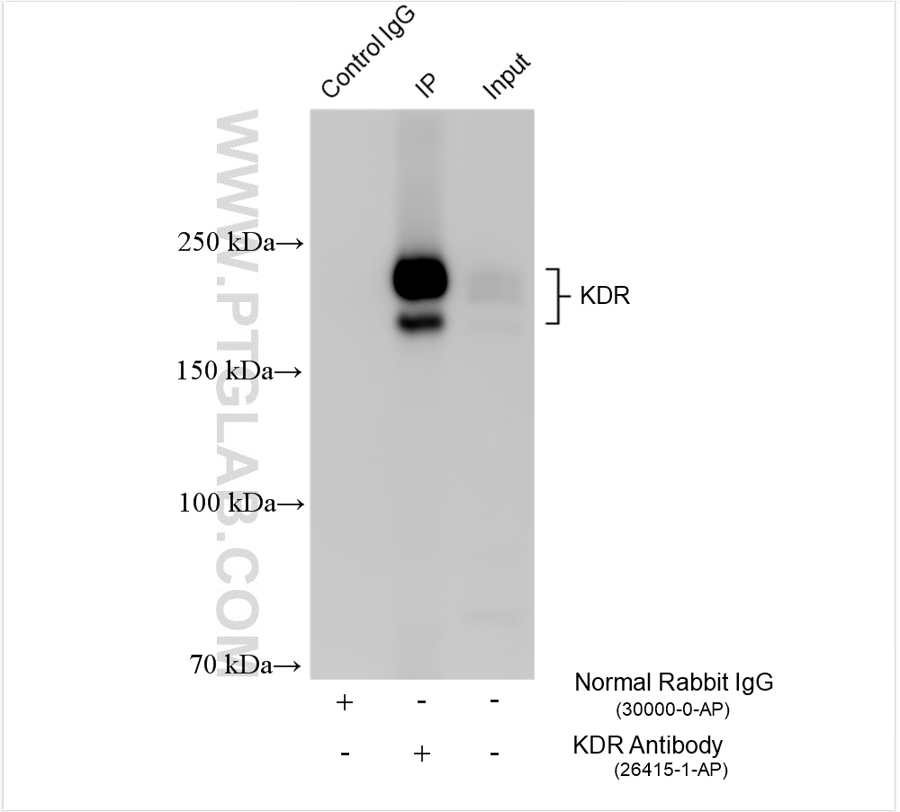 Immunoprecipitation (IP) experiment of rat skeletal muscle tissue using VEGFR2/KDR Polyclonal antibody (26415-1-AP)