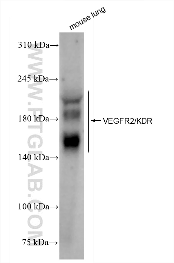 Western Blot (WB) analysis of mouse lung tissue using VEGFR2/KDR Recombinant antibody (83366-1-RR)