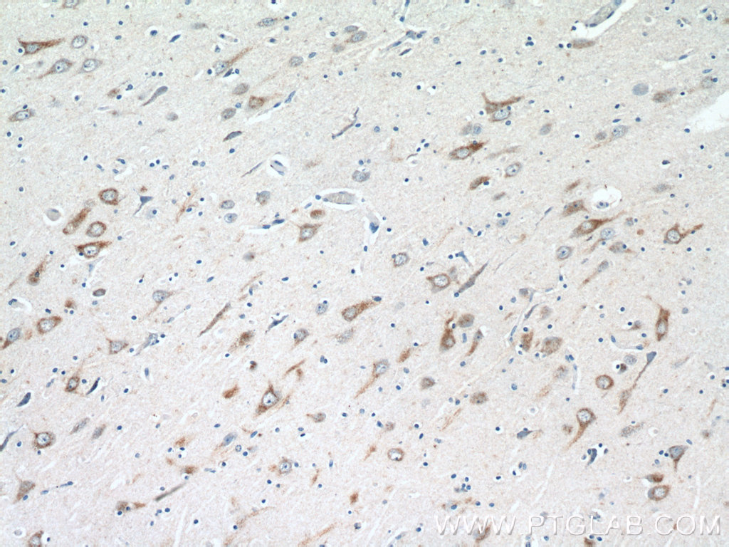 Immunohistochemistry (IHC) staining of human brain tissue using VGF Polyclonal antibody (26781-1-AP)