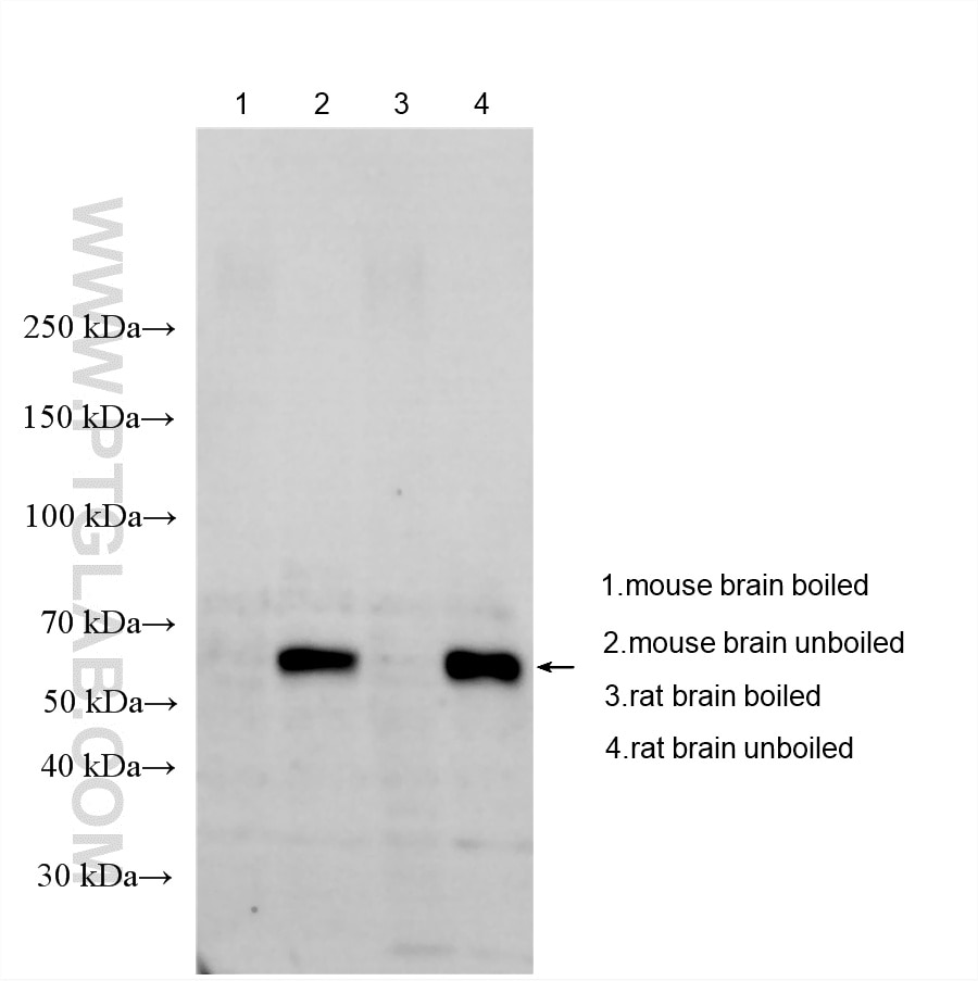 Western Blot (WB) analysis of various lysates using VGLUT2 Polyclonal antibody (25261-1-AP)