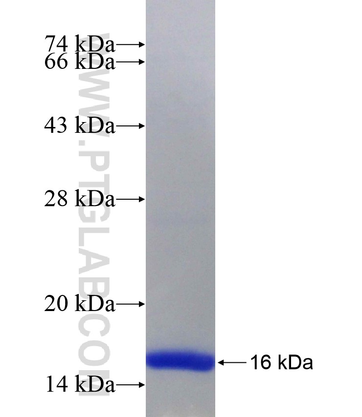 VHL fusion protein Ag28860 SDS-PAGE