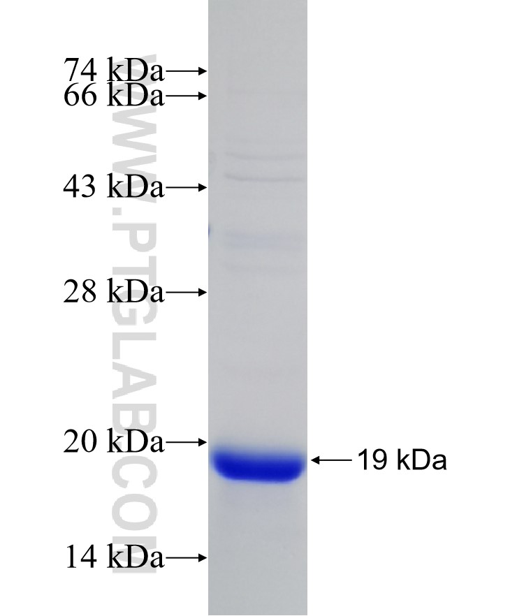 VHL fusion protein Ag21455 SDS-PAGE