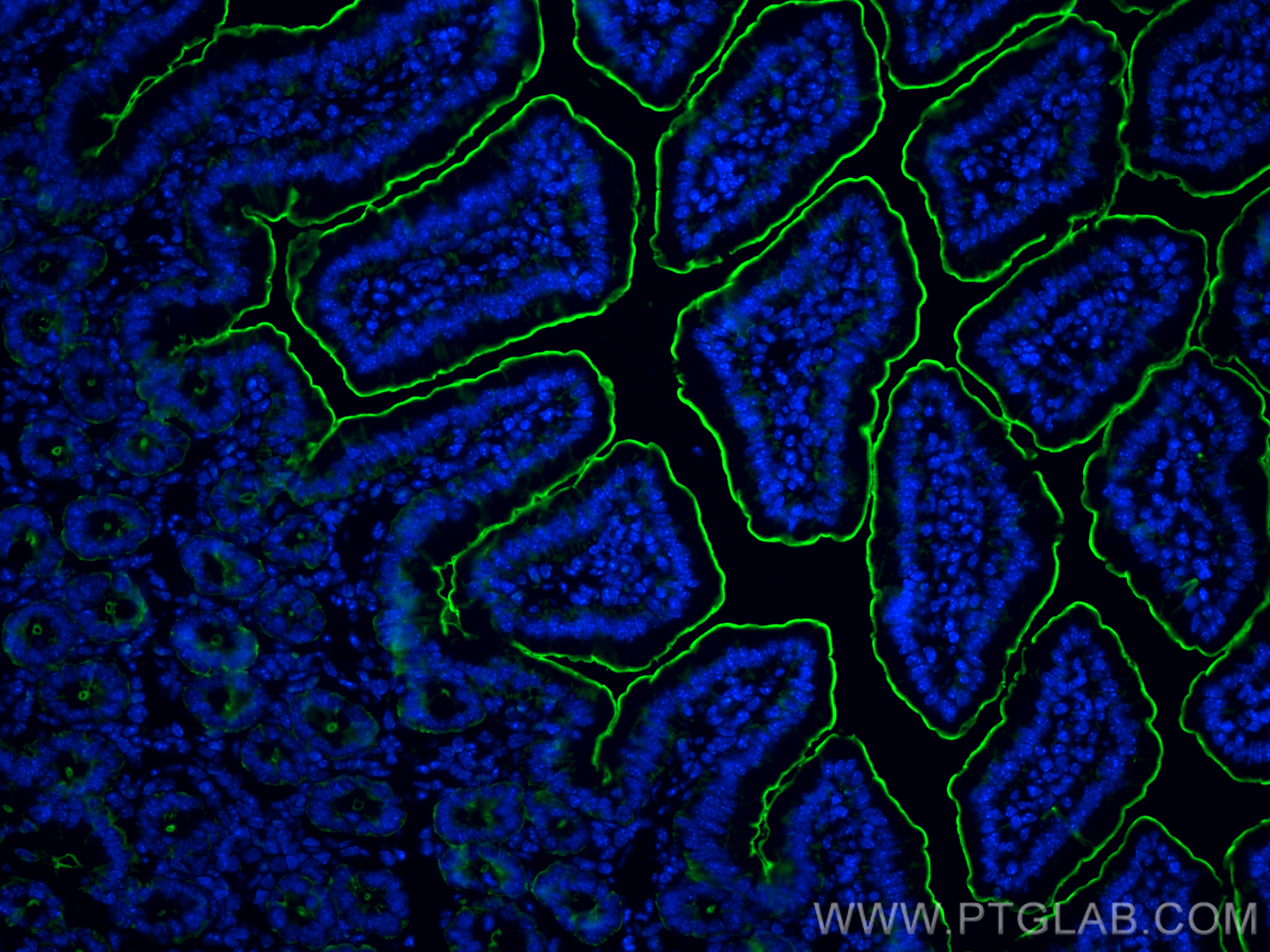 Immunofluorescence (IF) / fluorescent staining of mouse small intestine tissue using Villin Polyclonal antibody (16488-1-AP)