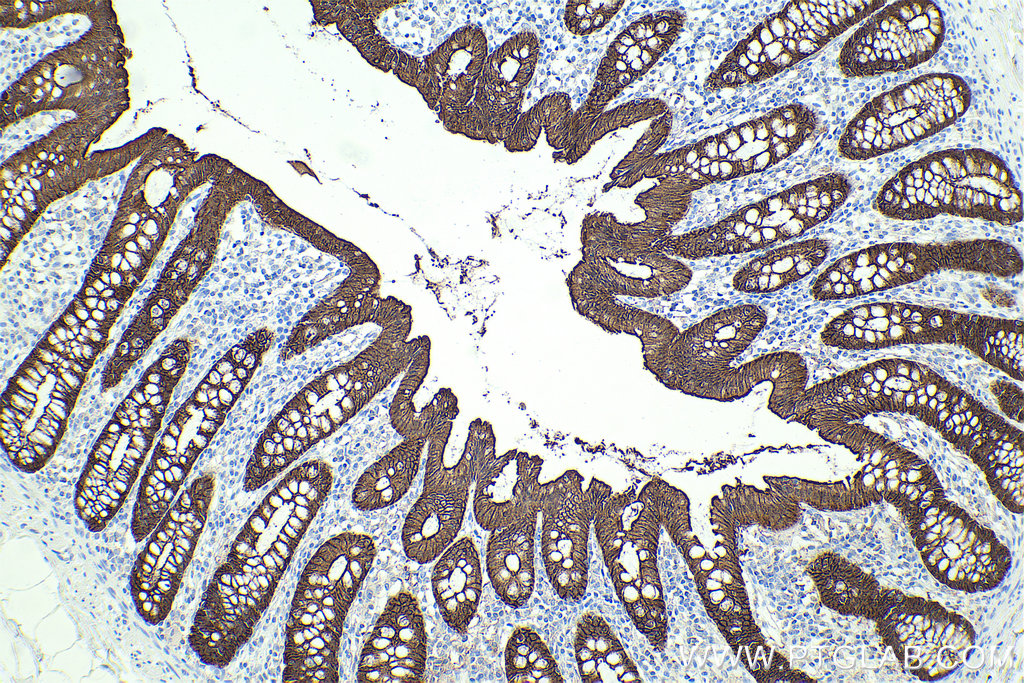 Immunohistochemistry (IHC) staining of human colon tissue using Villin Monoclonal antibody (66096-1-Ig)