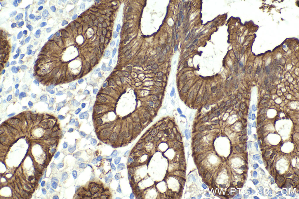 Immunohistochemistry (IHC) staining of human colon tissue using Villin Monoclonal antibody (66096-1-Ig)