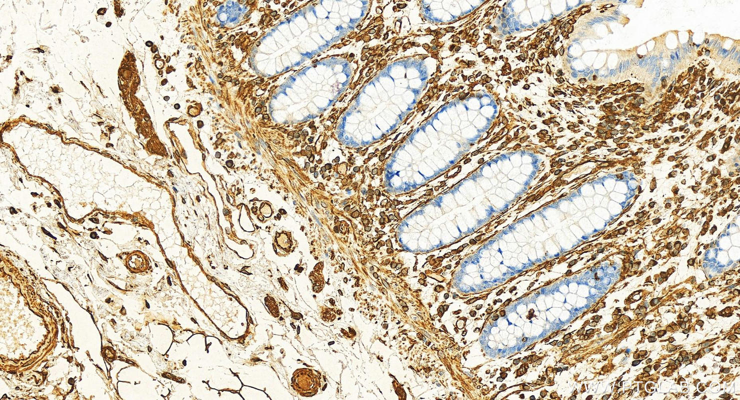 Immunohistochemistry (IHC) staining of human normal colon using Vimentin Polyclonal antibody (10366-1-AP)