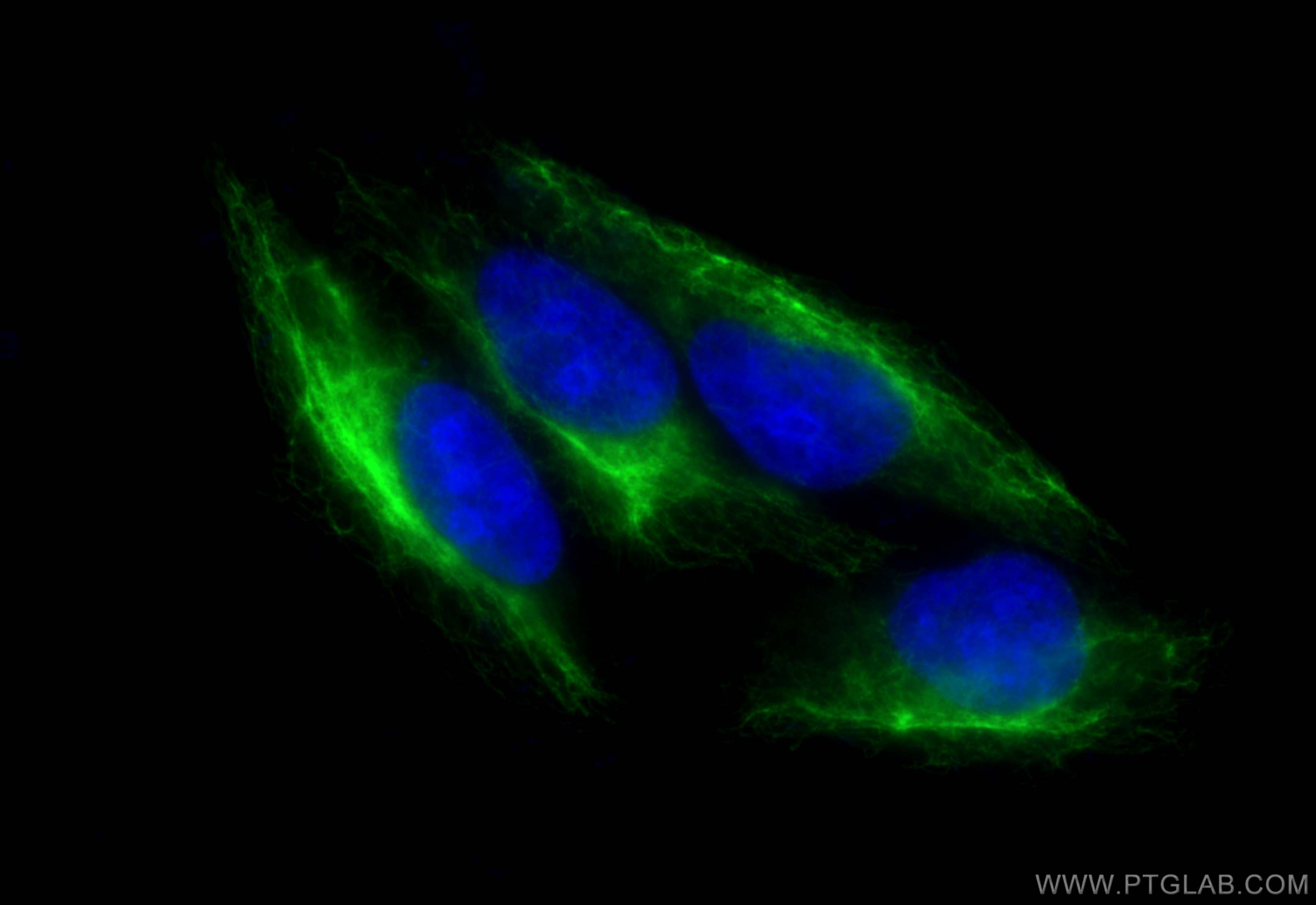 Immunofluorescence (IF) / fluorescent staining of HepG2 cells using Vimentin Polyclonal antibody (10366-1-AP)