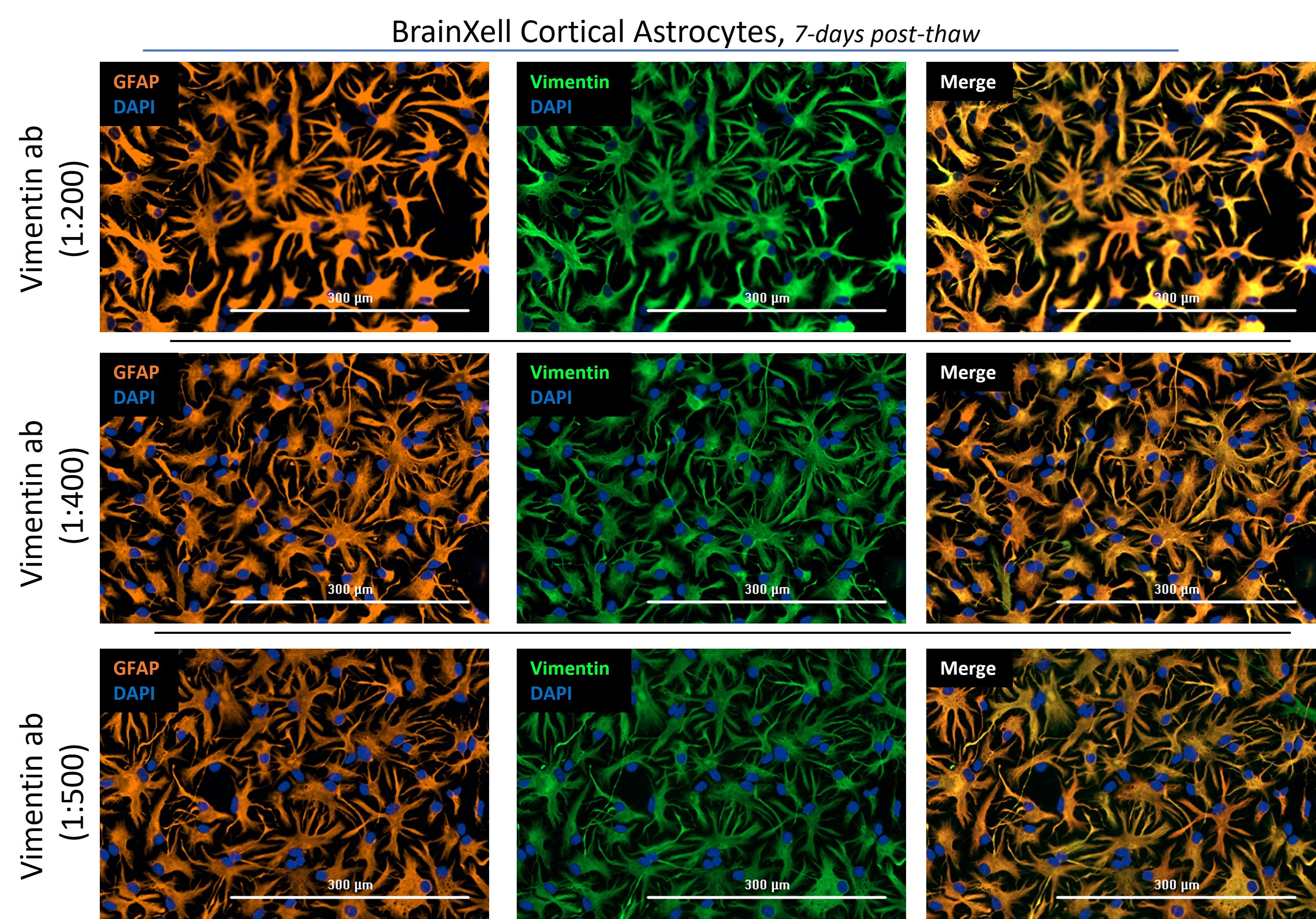 Immunofluorescence (IF) / fluorescent staining of hiPSC-derived cortical astrocytes (7 DIV) using Vimentin Polyclonal antibody (10366-1-AP)