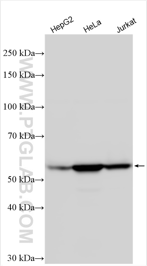 Western Blot (WB) analysis of various lysates using Vimentin Polyclonal antibody (10366-1-AP)