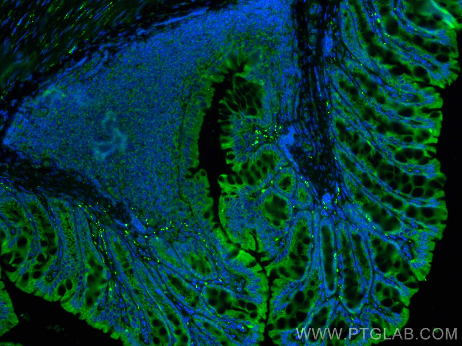 Immunofluorescence (IF) / fluorescent staining of mouse colon tissue using VIP Polyclonal antibody (16233-1-AP)