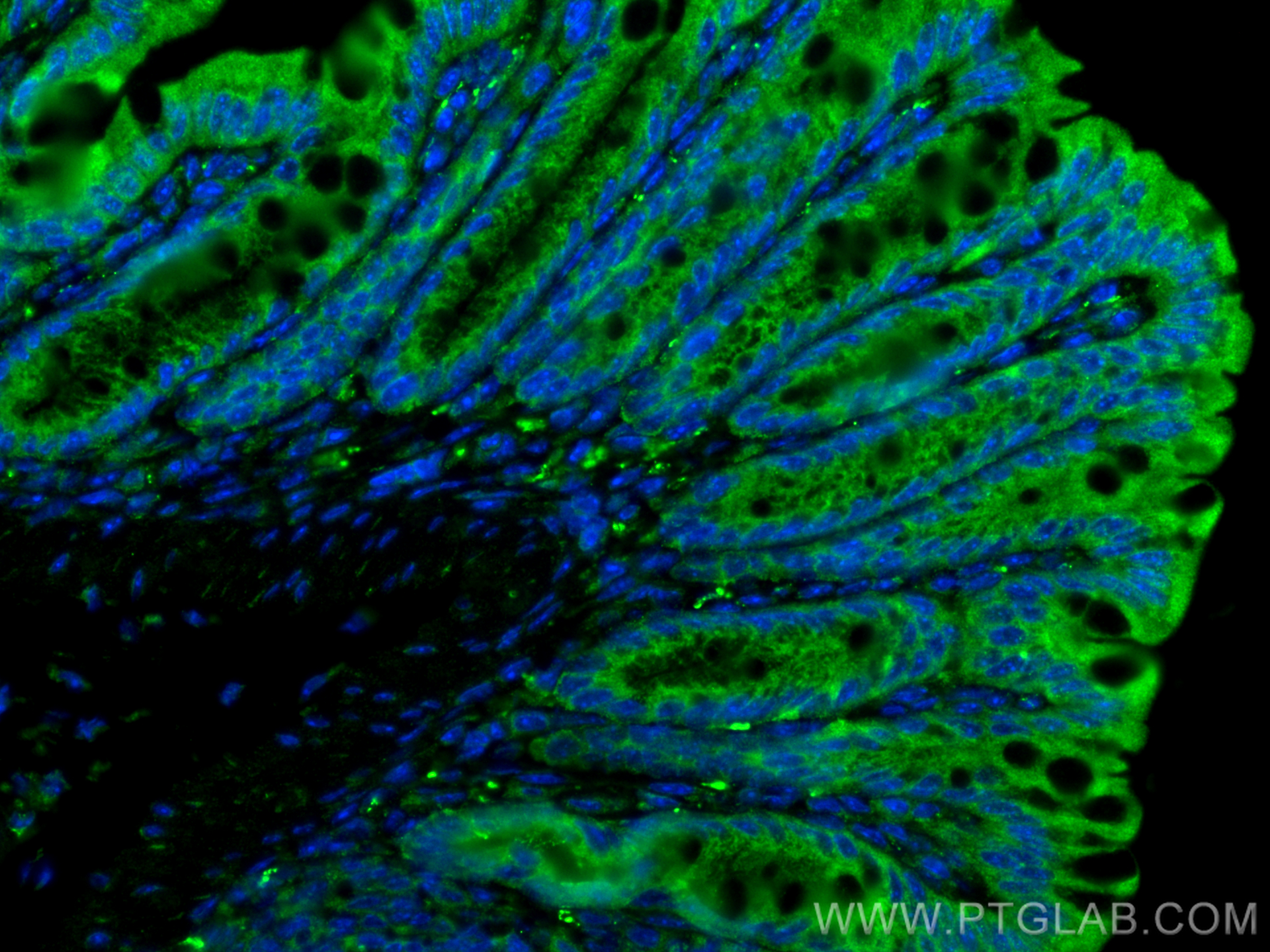Immunofluorescence (IF) / fluorescent staining of mouse colon tissue using VIP Polyclonal antibody (16233-1-AP)
