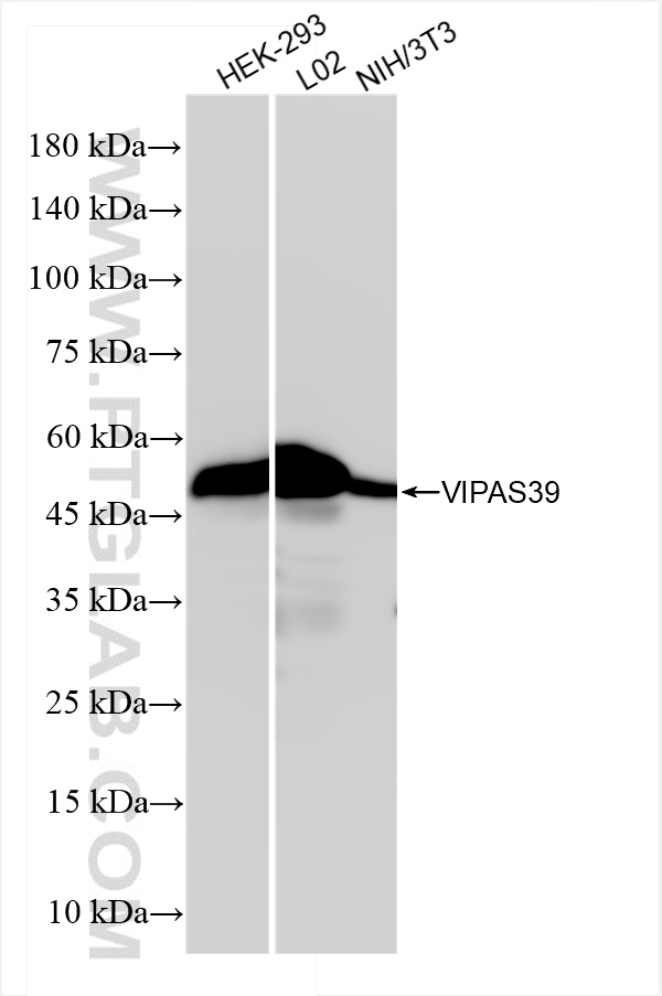 Western Blot (WB) analysis of various lysates using VIPAS39 Recombinant antibody (84320-2-RR)