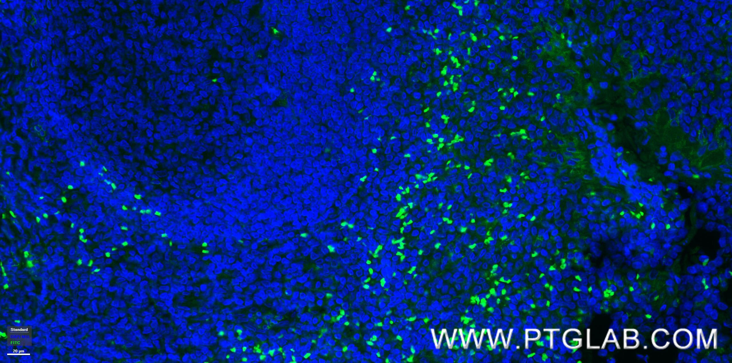 Immunofluorescence (IF) / fluorescent staining of human tonsillitis tissue using VISTA Recombinant antibody (83919-4-RR)