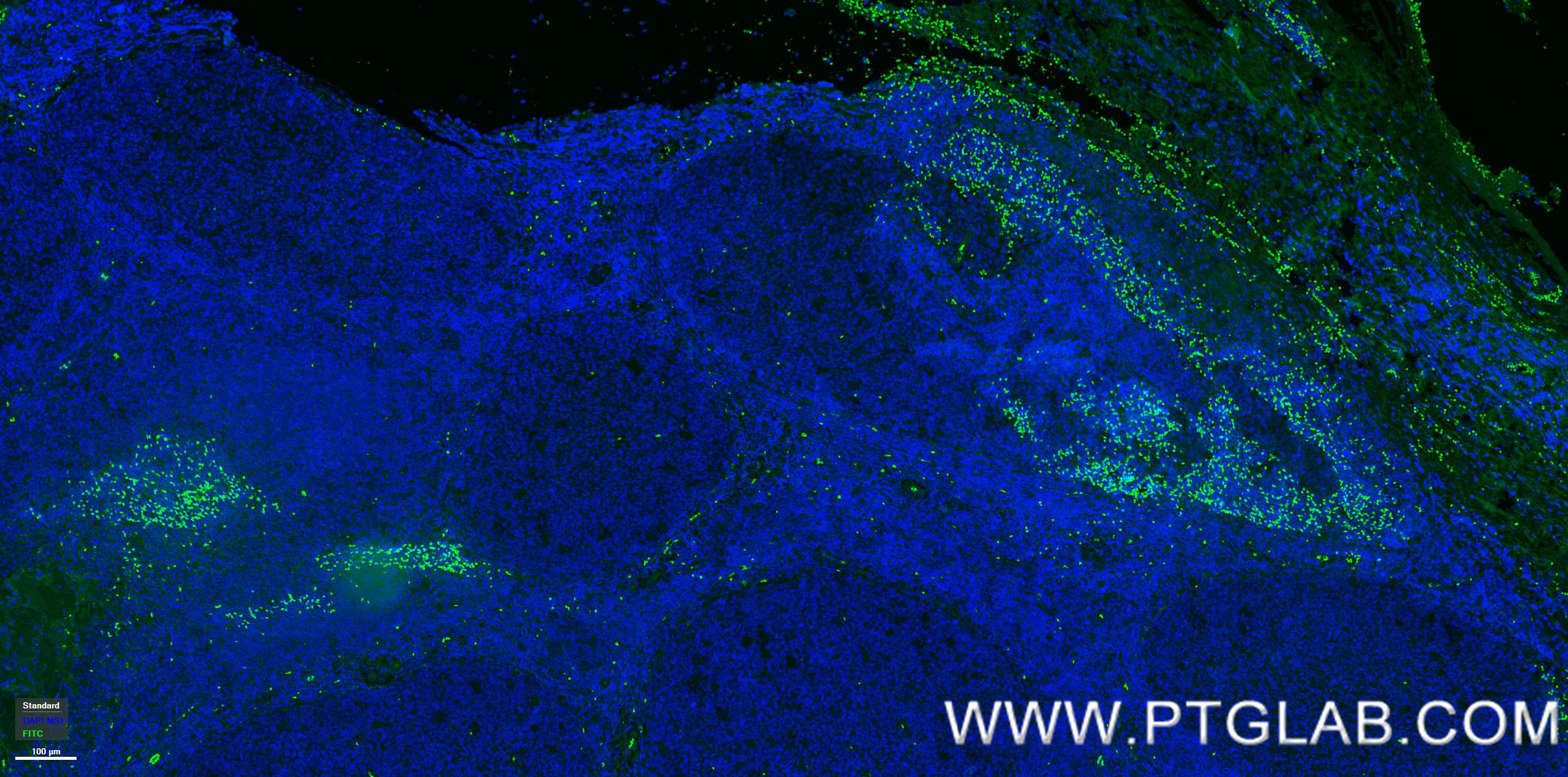 Immunofluorescence (IF) / fluorescent staining of human tonsillitis tissue using VISTA Recombinant antibody (83919-4-RR)