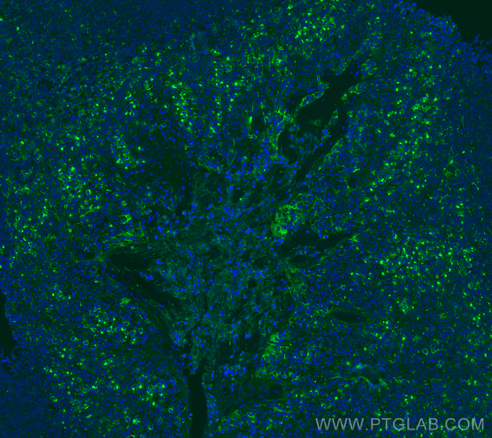 Immunofluorescence (IF) / fluorescent staining of human tonsillitis tissue using VISTA Recombinant antibody (83919-4-RR)